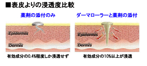 dermaroller2.gif