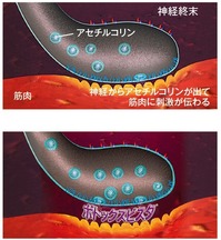 Botox_mechanism.jpg