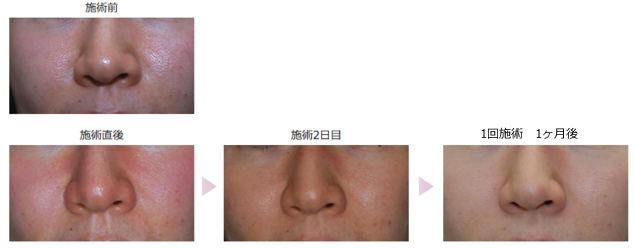co2oo2-thumb-635x249-4423.png