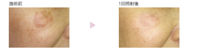 j3c.png