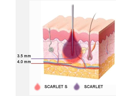 scarlet_img003.png