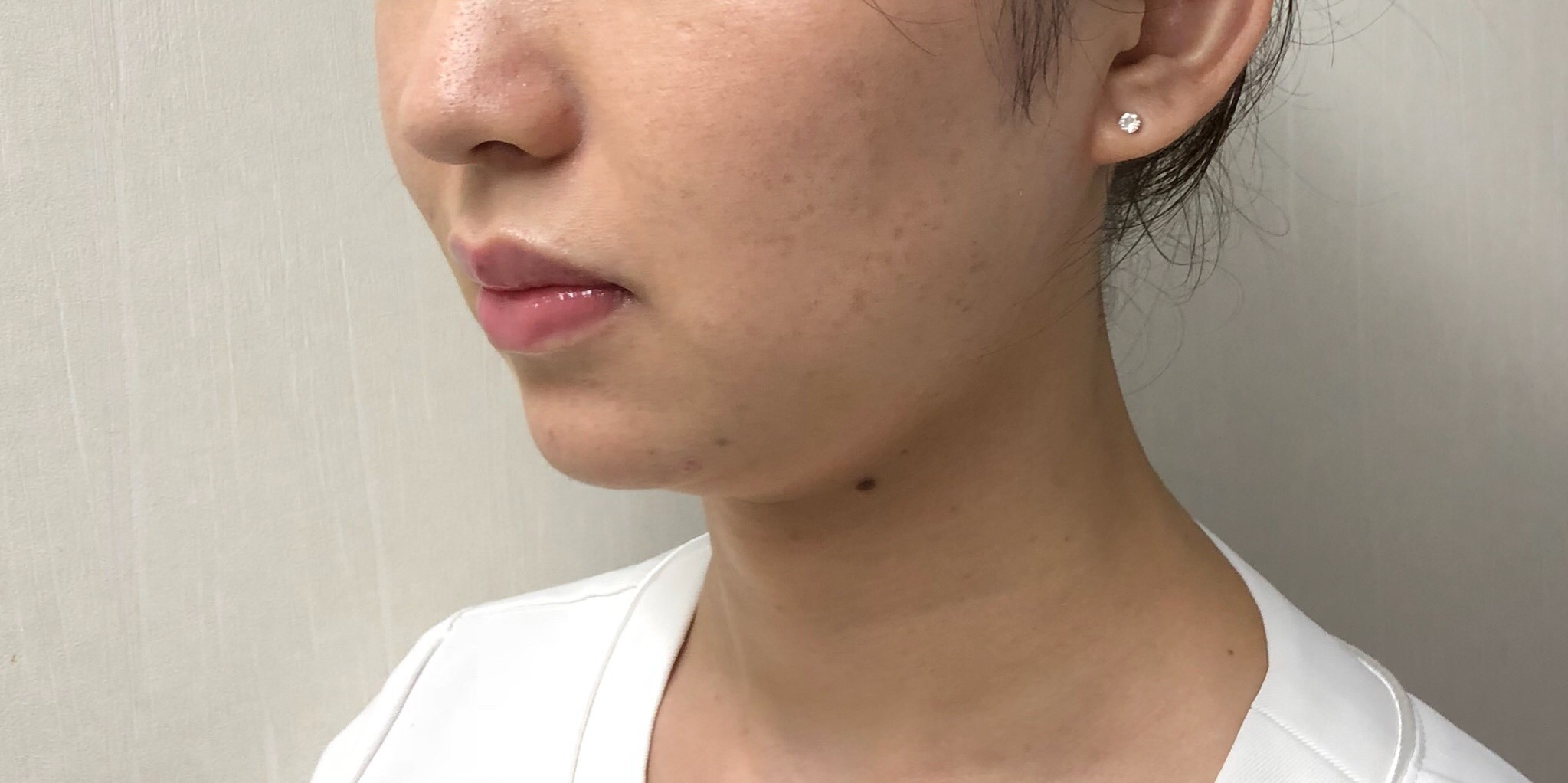 After（アフター）