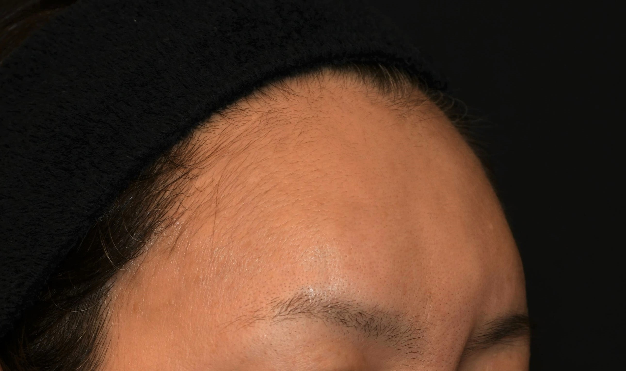 Before（ビフォー）