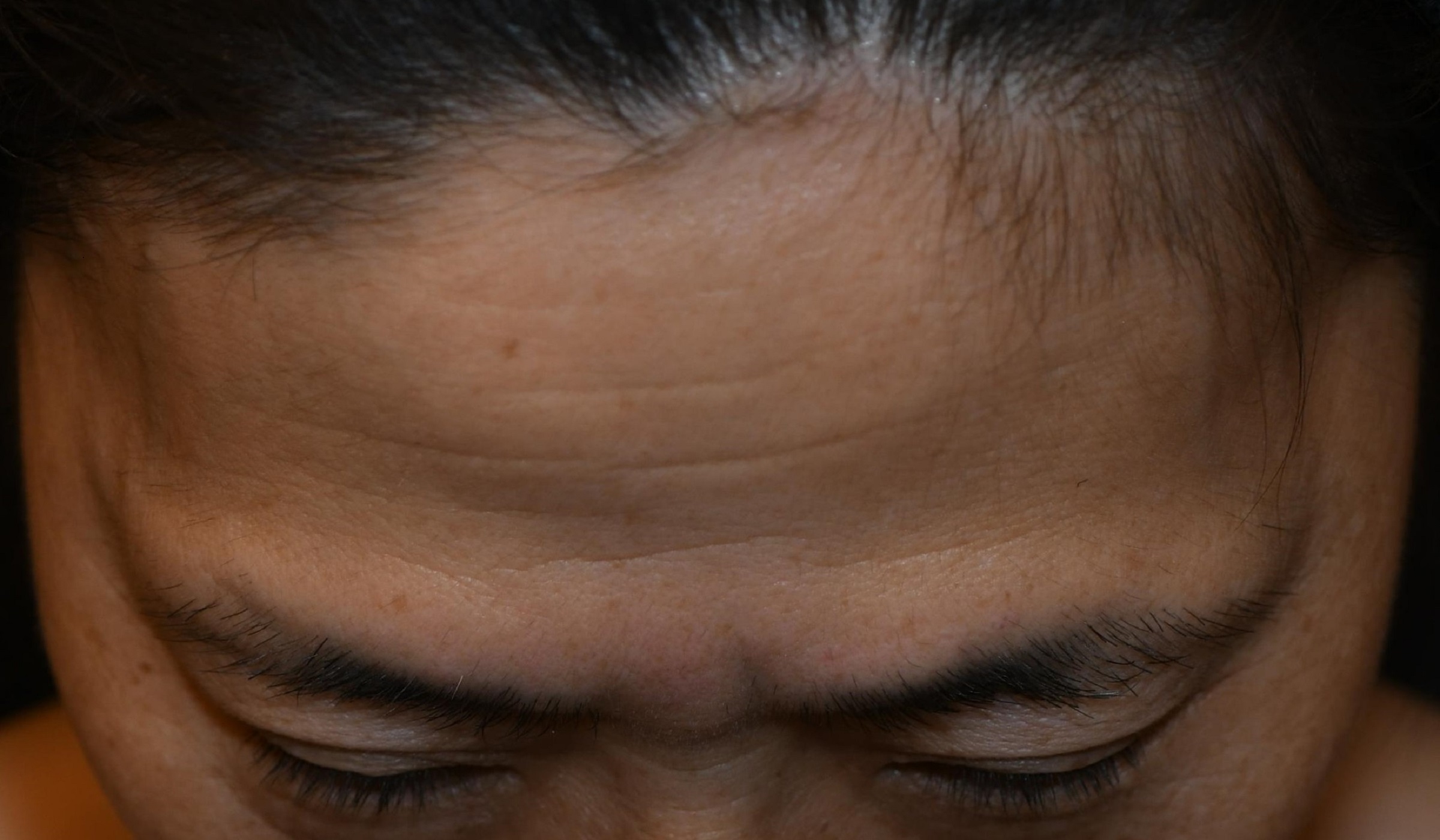 Before（ビフォー）