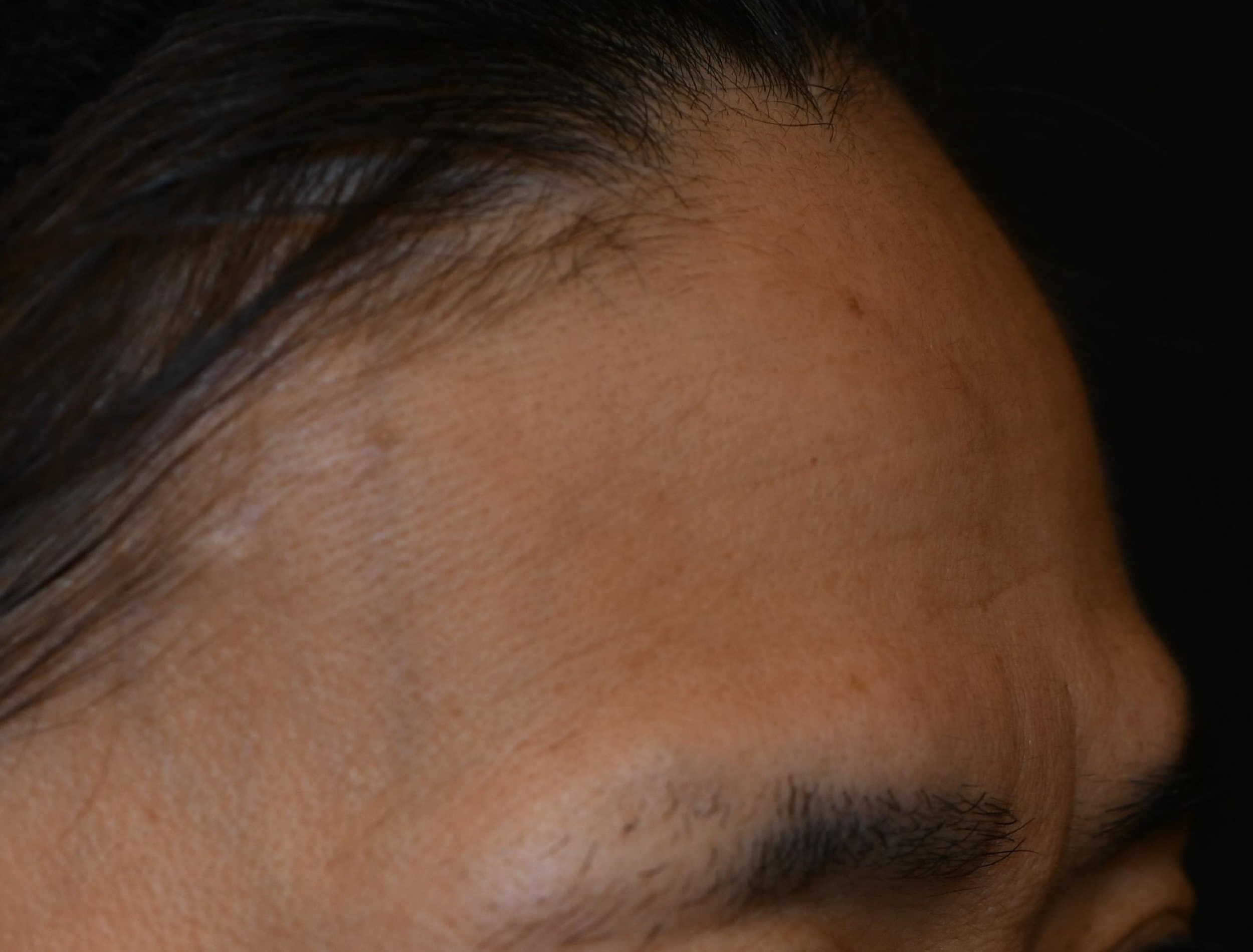 Before（ビフォー）
