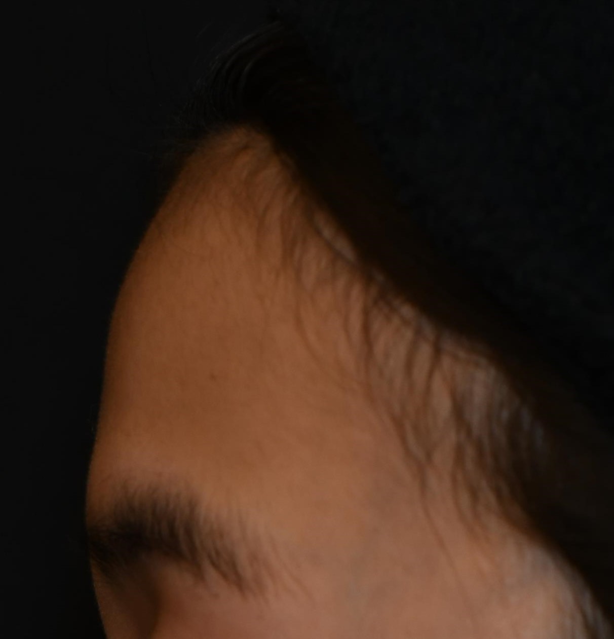 Before（ビフォー）