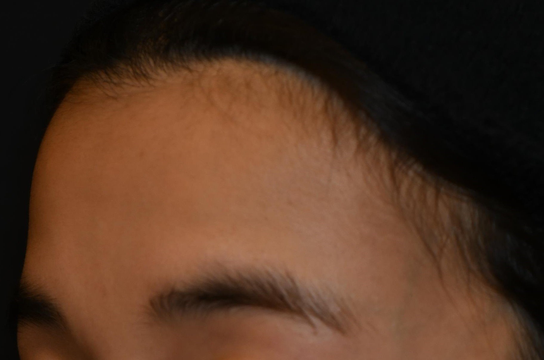 Before（ビフォー）