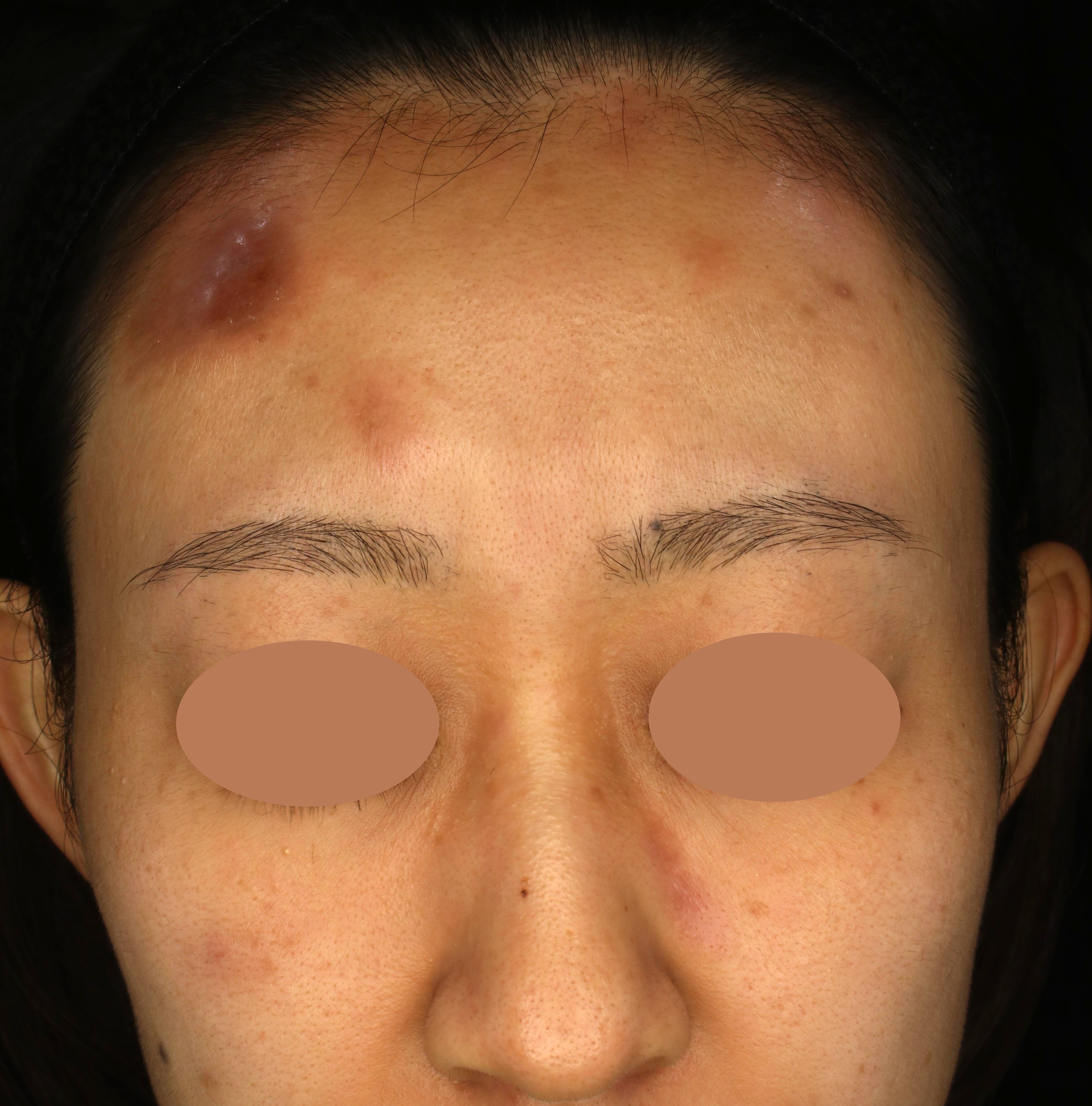 Before（ビフォー）