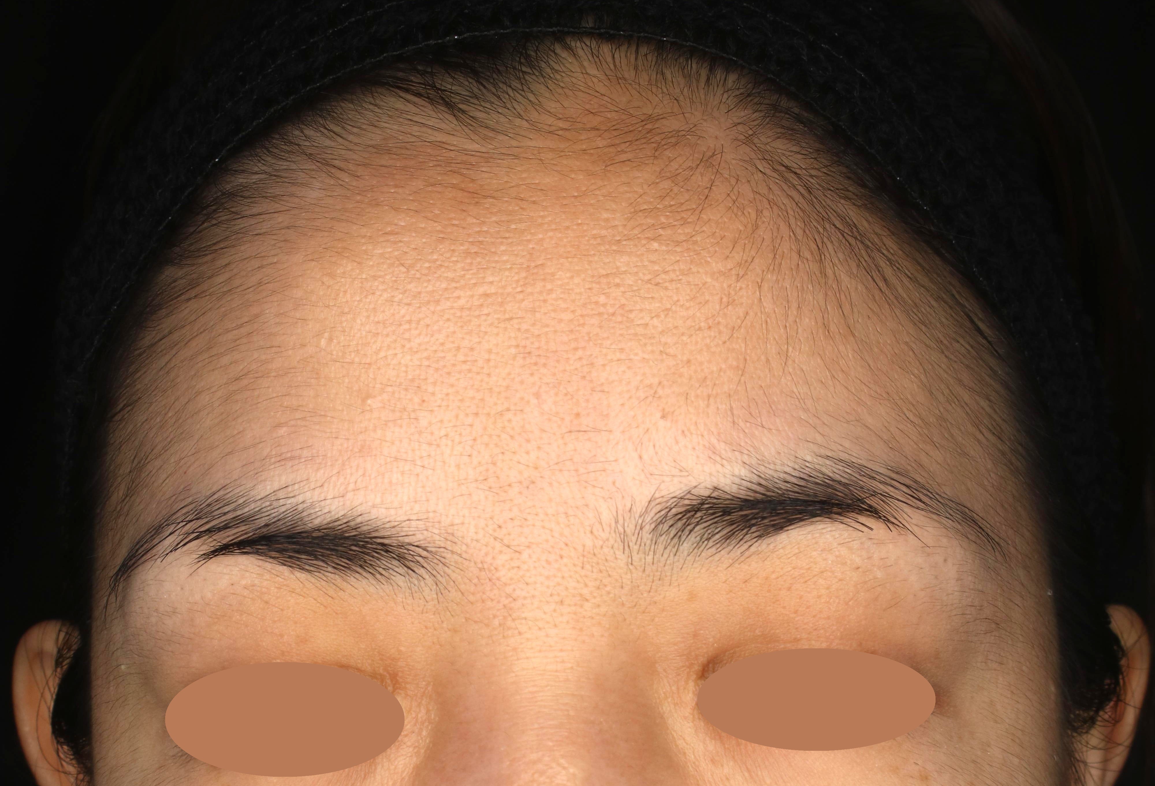 Before（ビフォー）