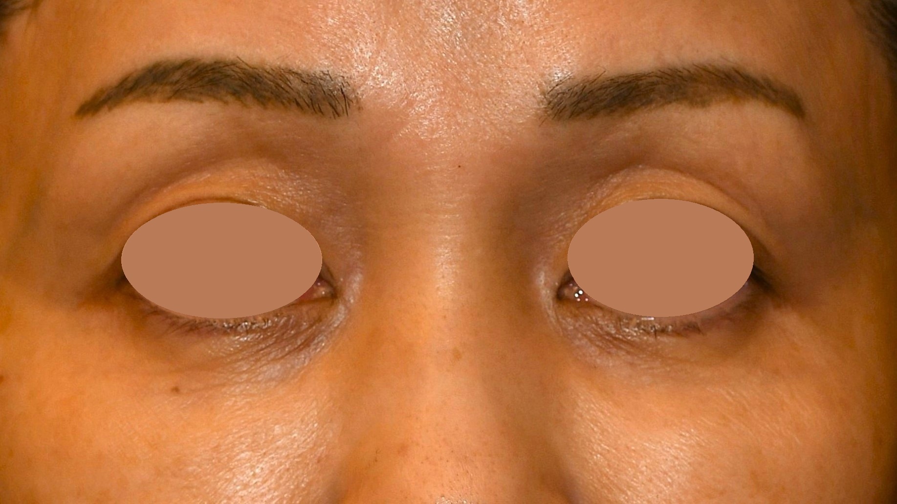 After（アフター）