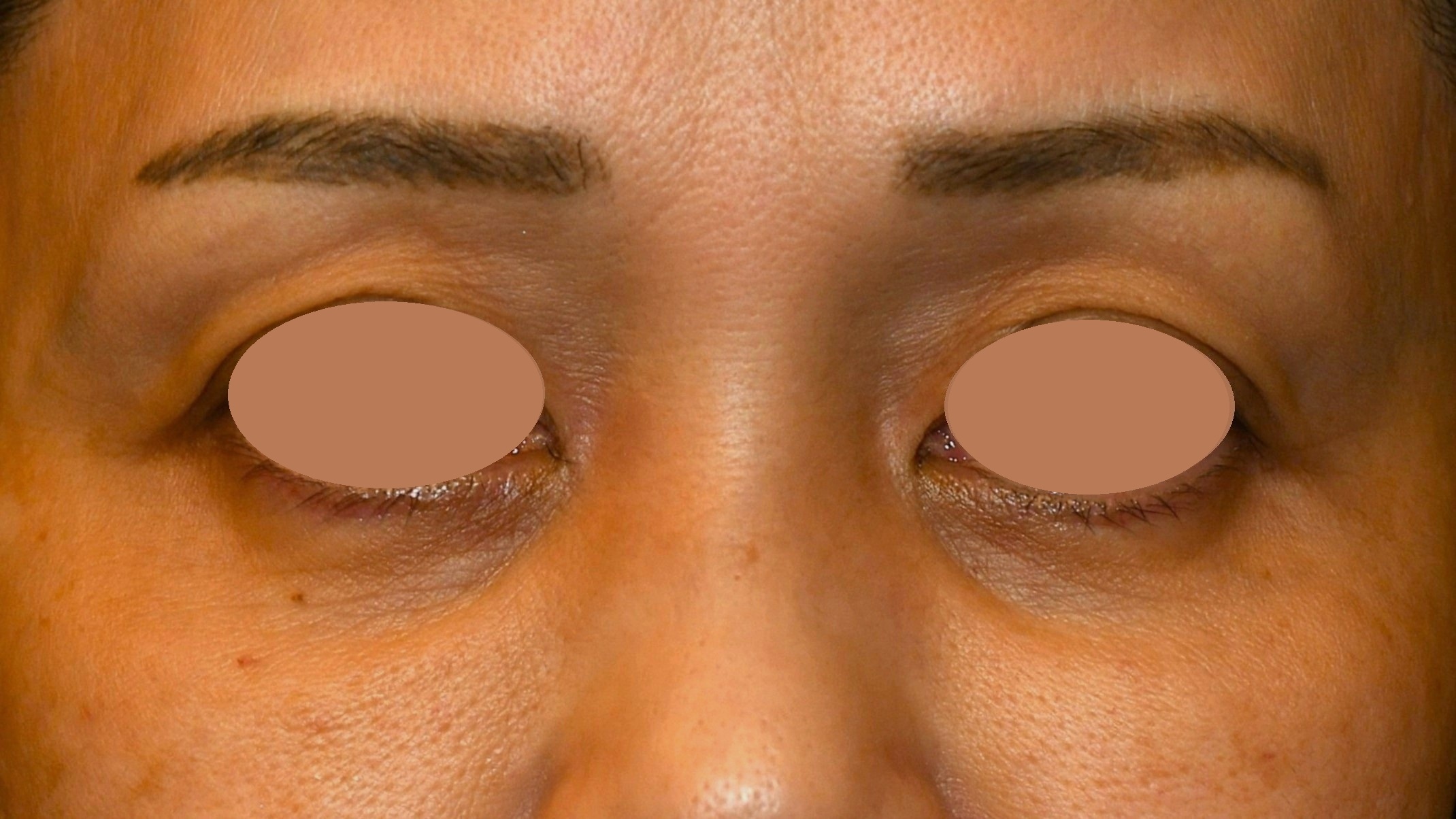 Before（ビフォー）