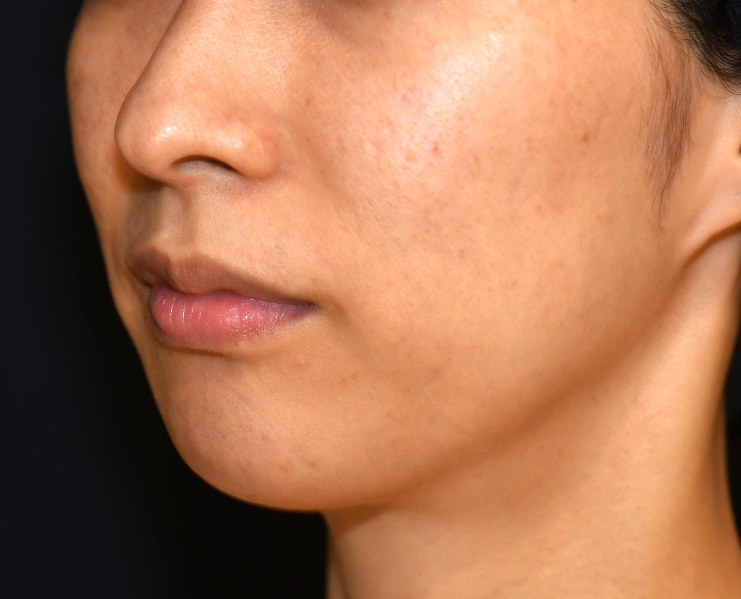 After（アフター）