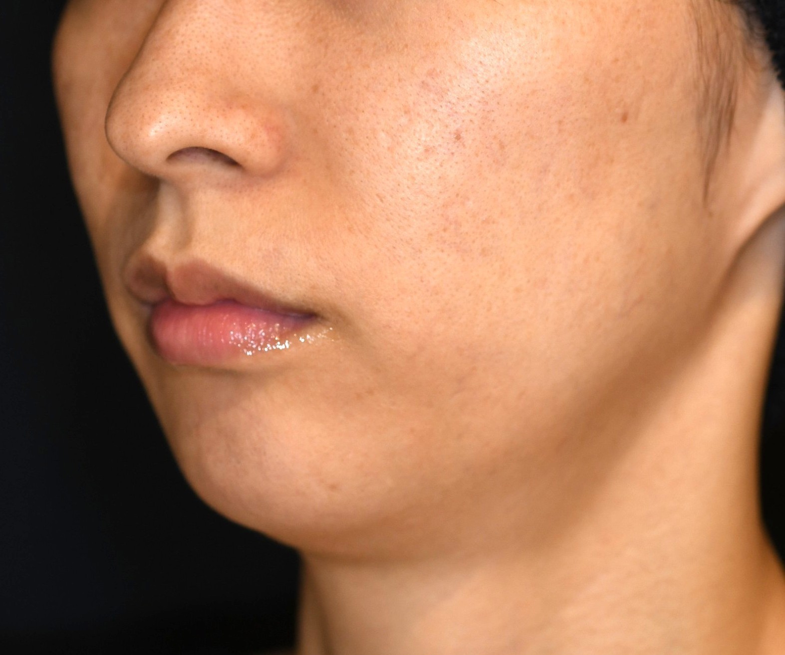 Before（ビフォー）