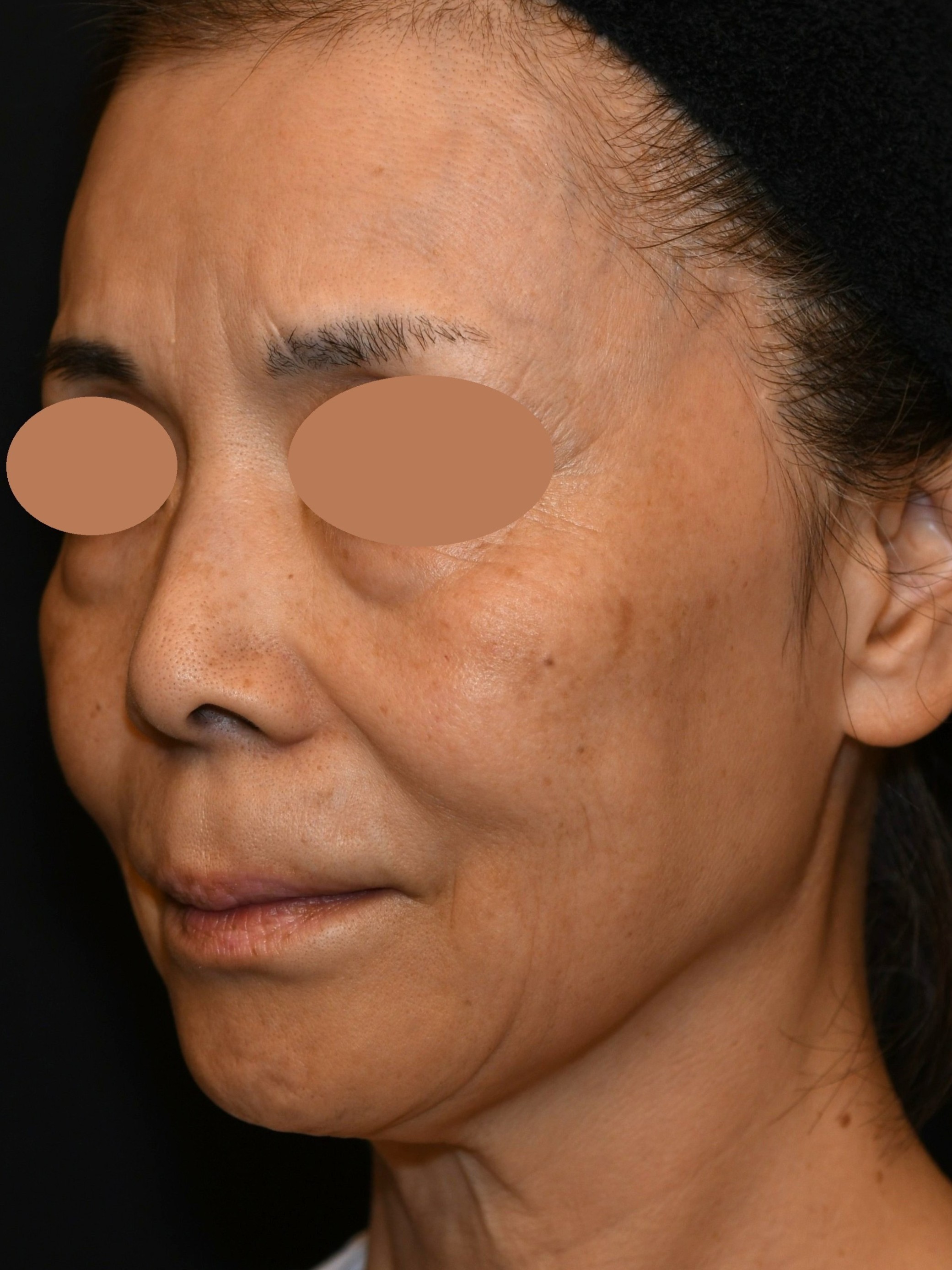 After（アフター）