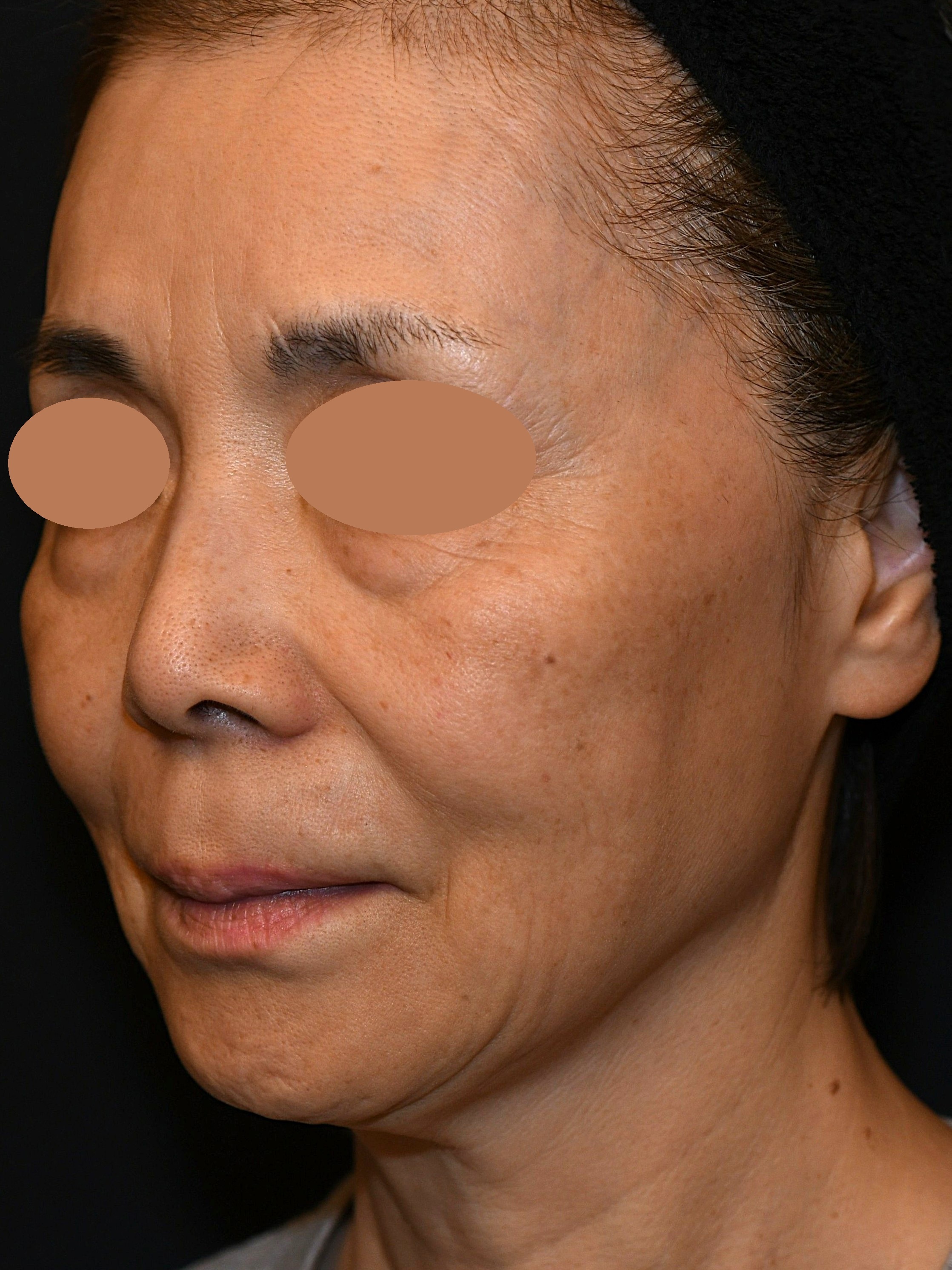 Before（ビフォー）