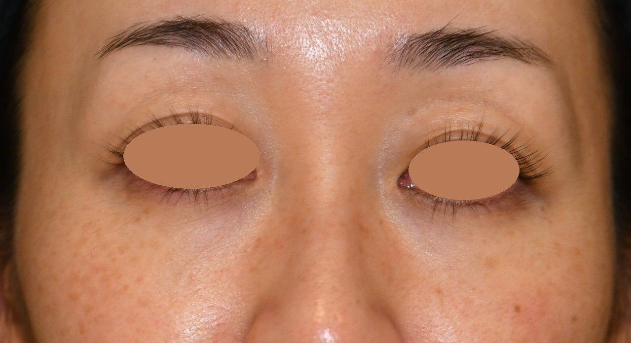 After（アフター）