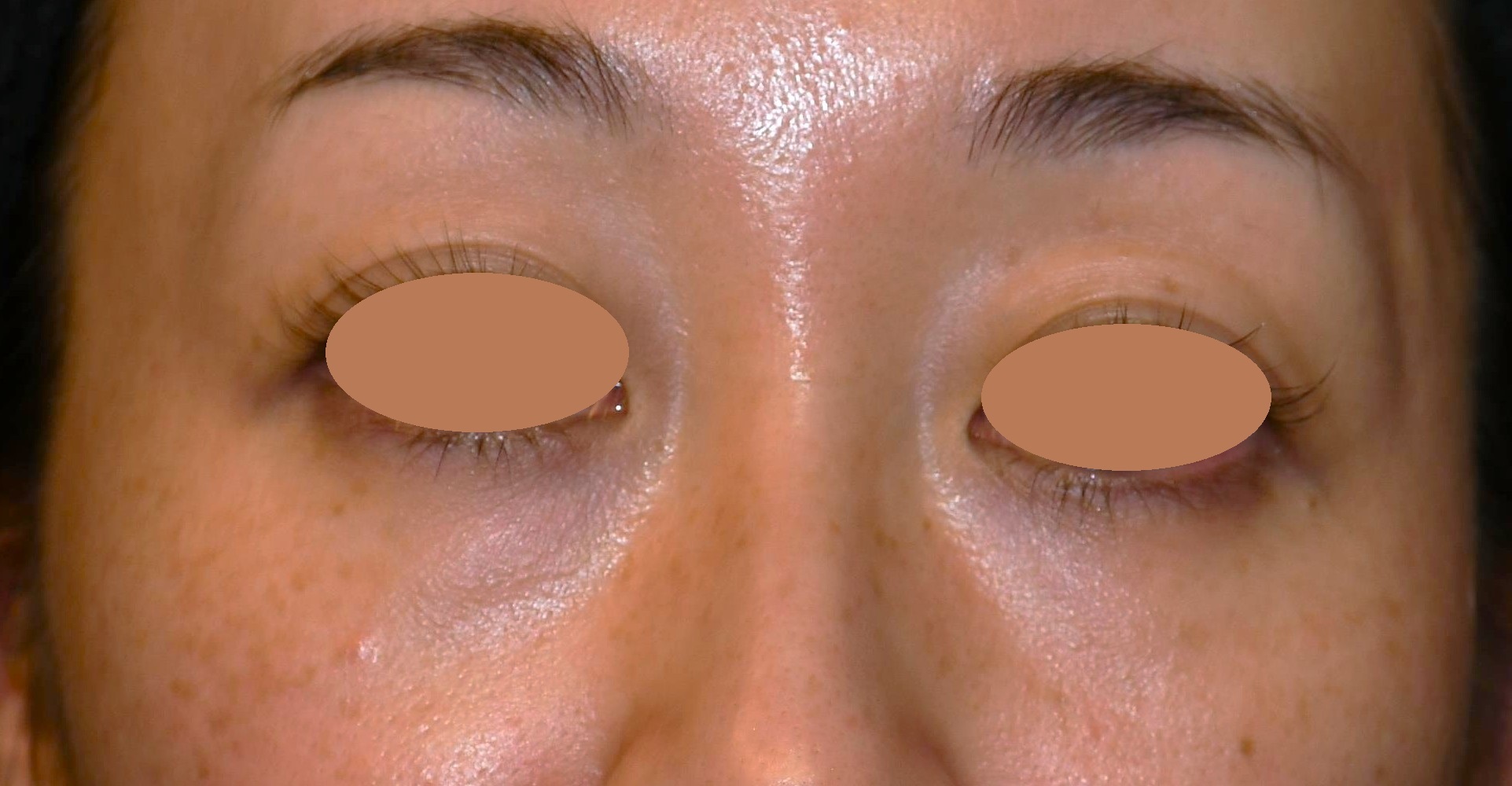 Before（ビフォー）