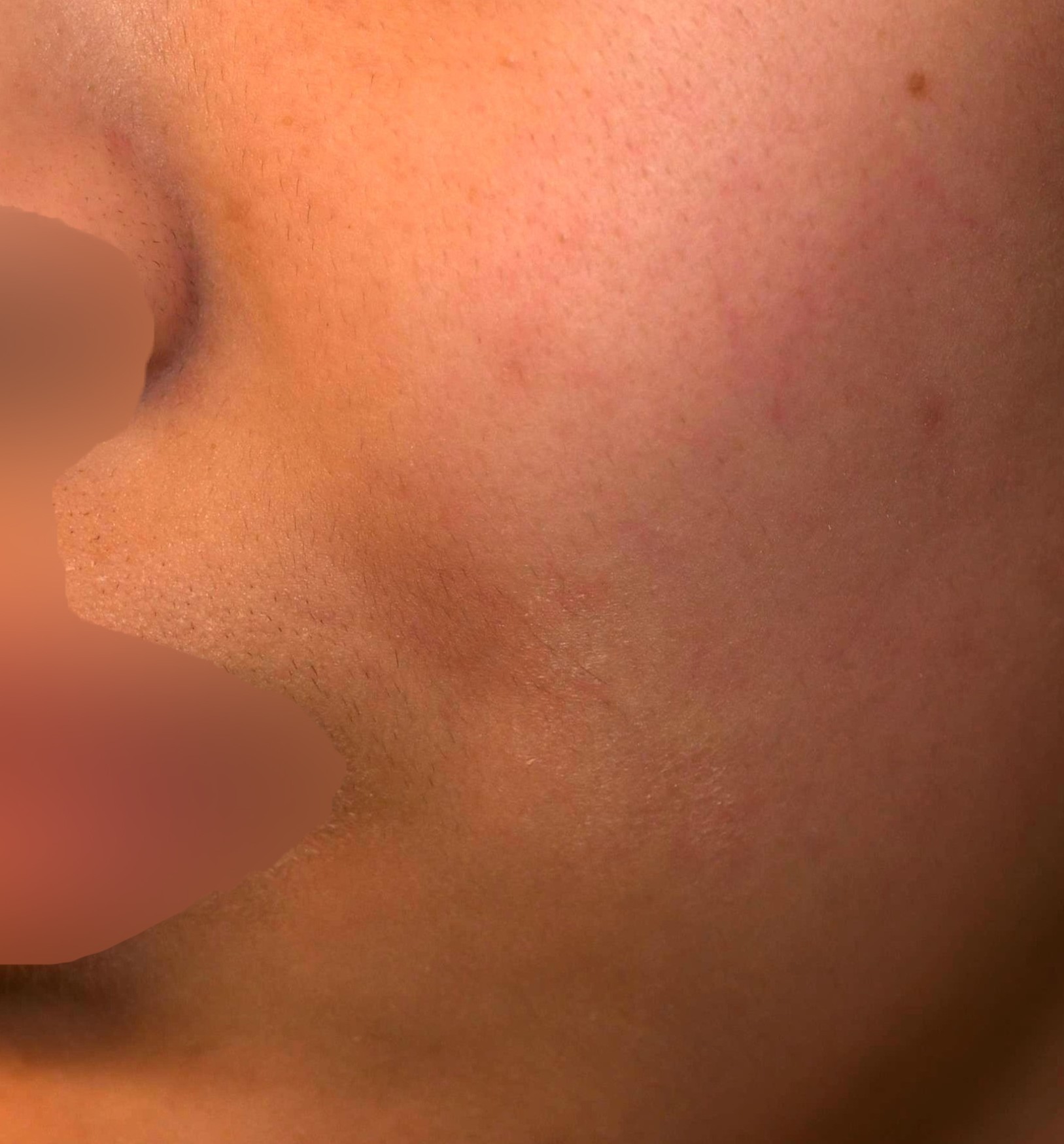 After（アフター）