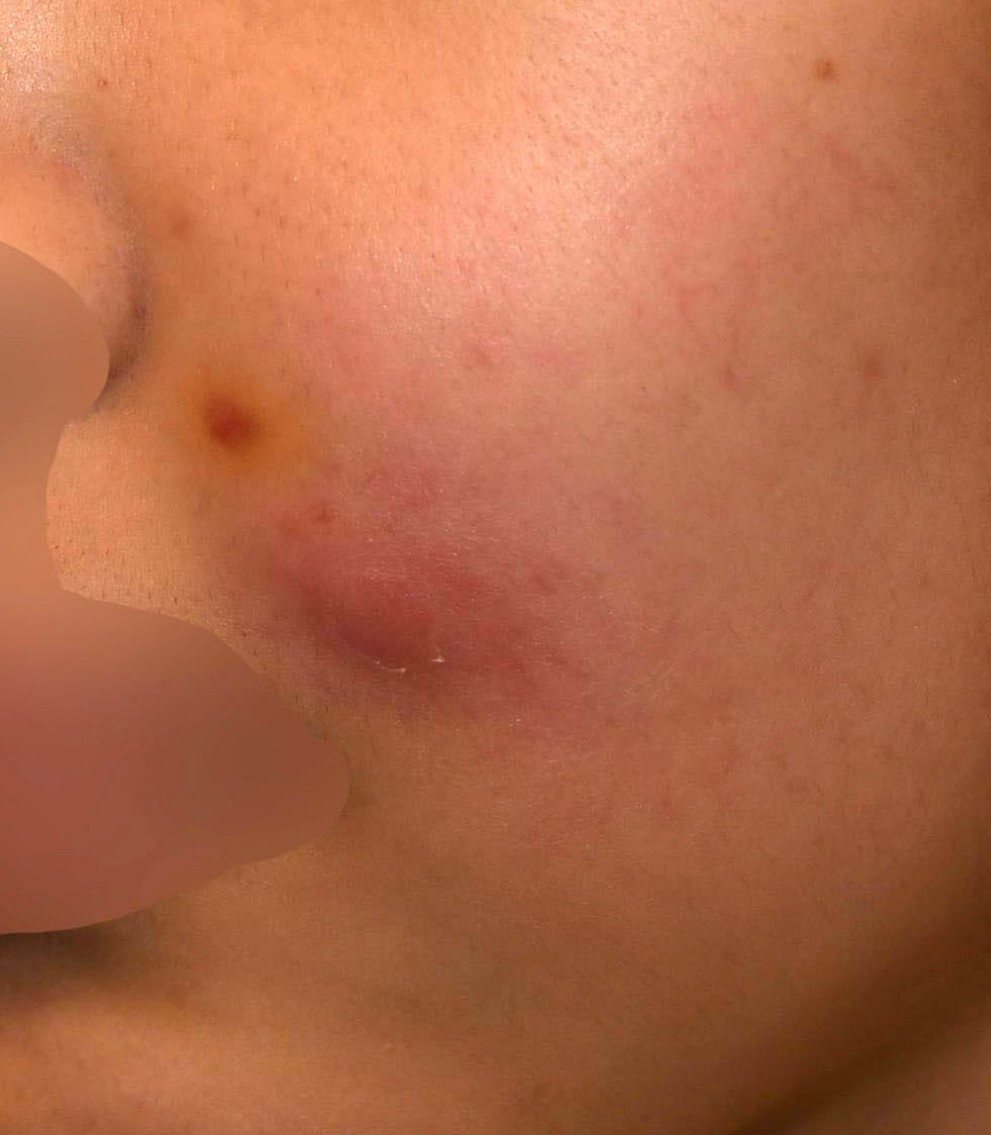 Before（ビフォー）