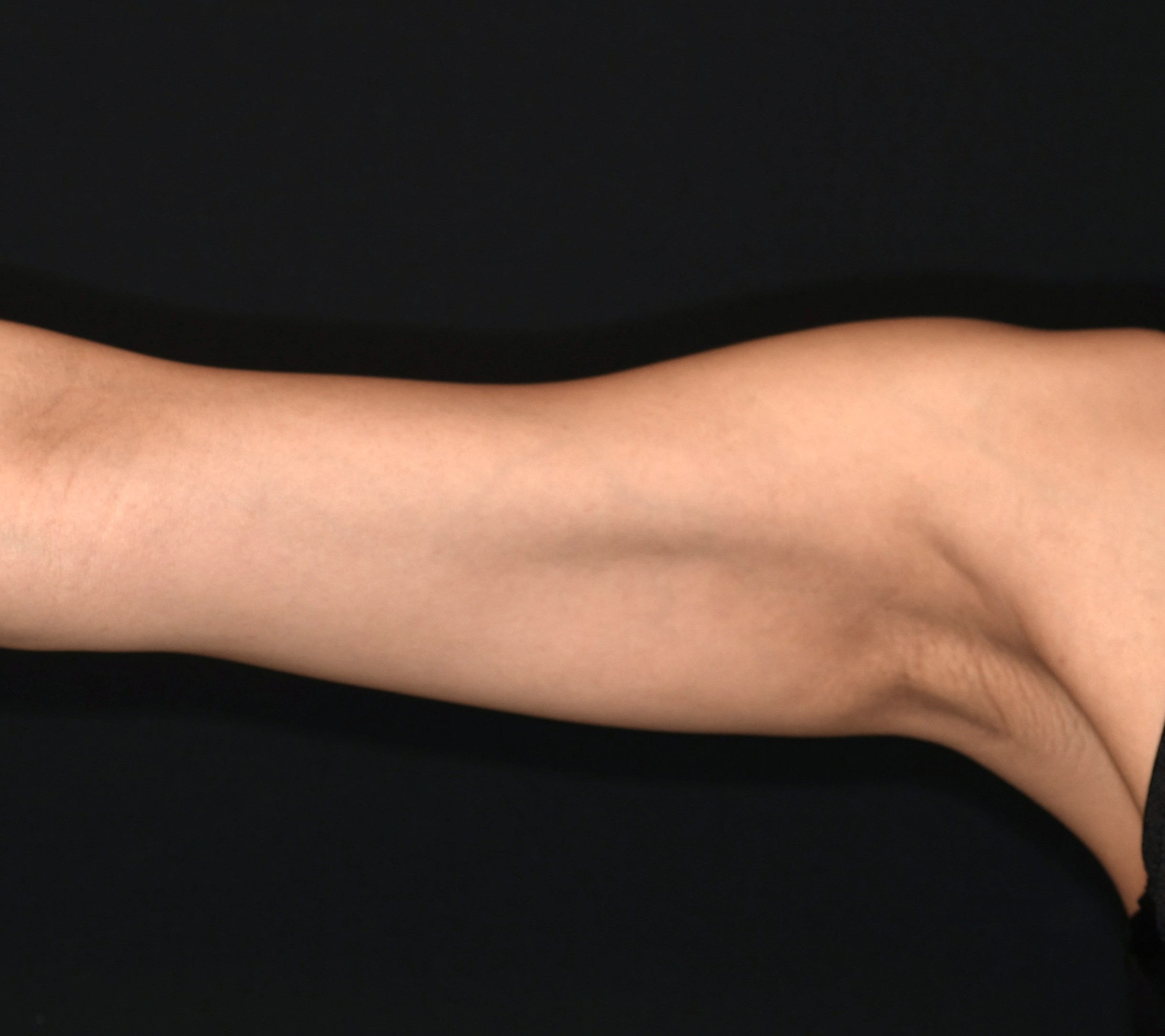 After（アフター）