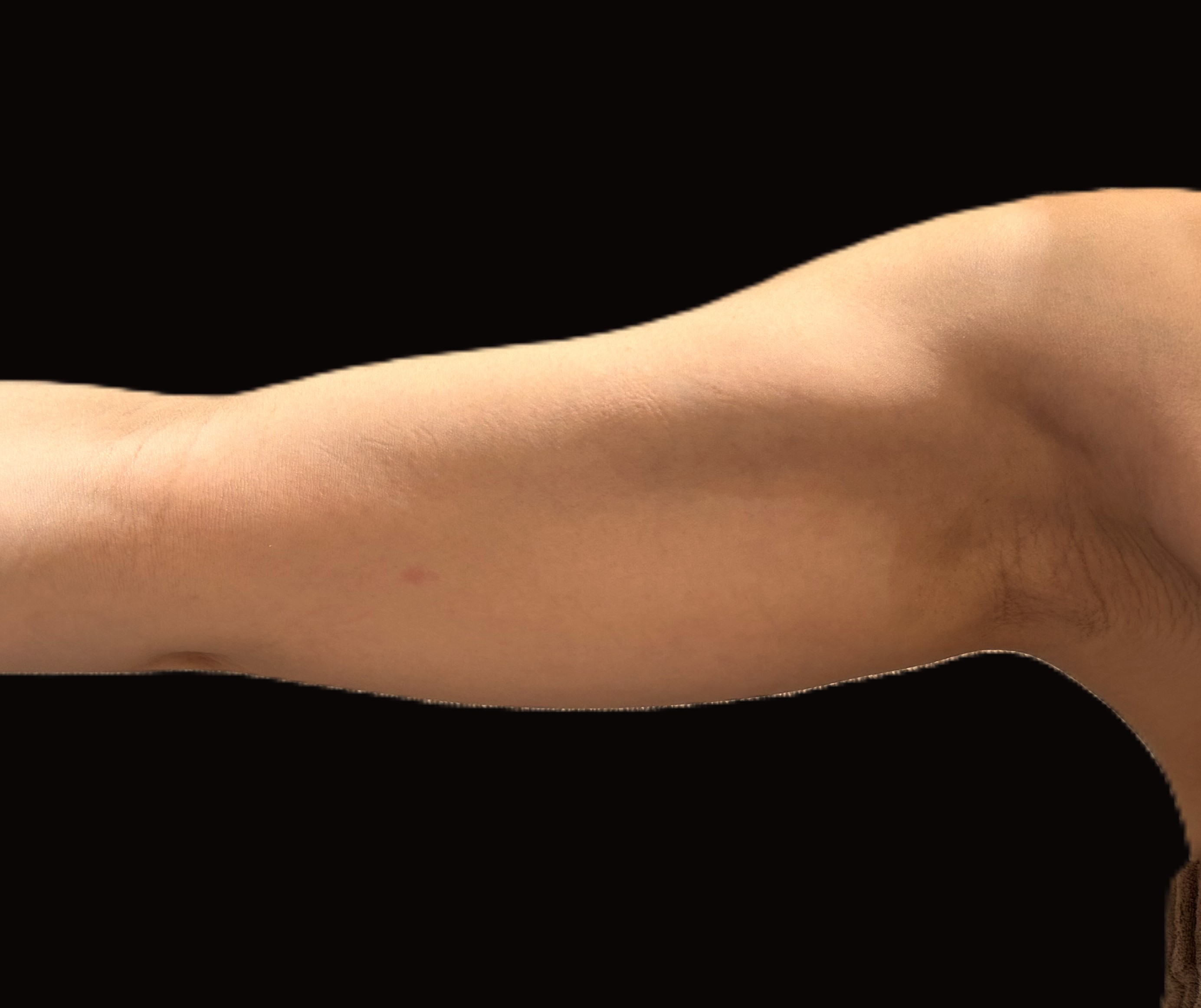 Before（ビフォー）