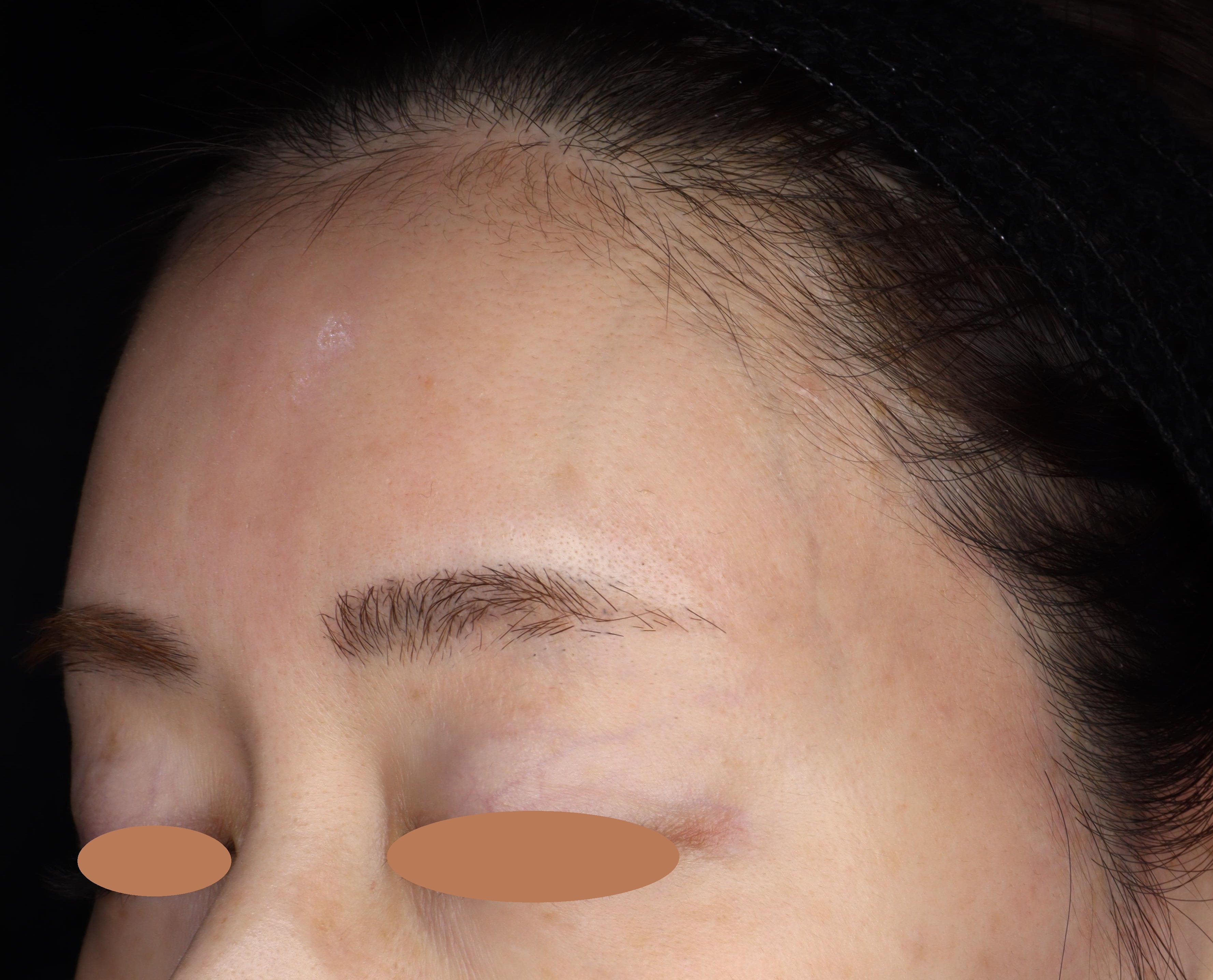 After（アフター）