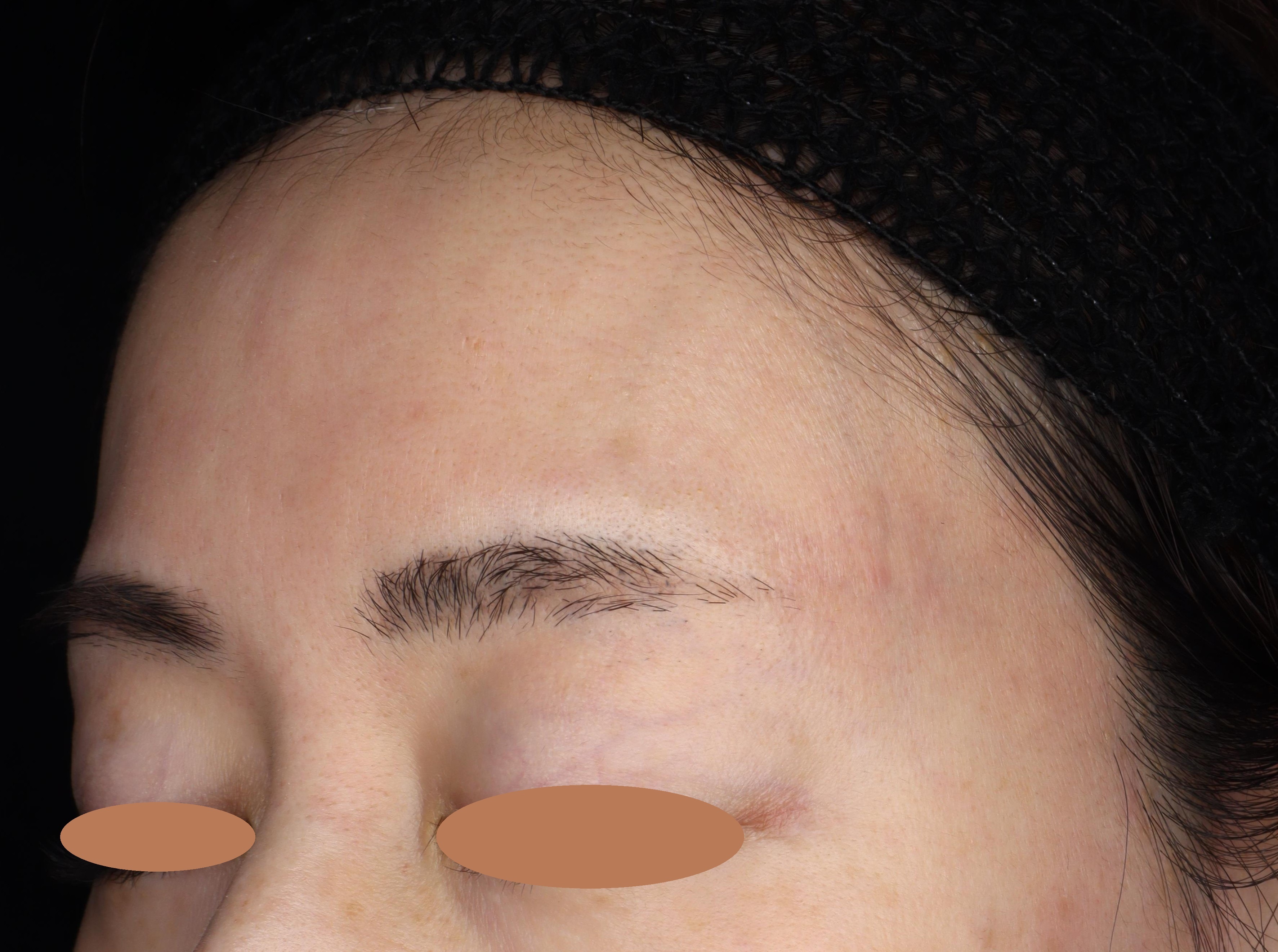 Before（ビフォー）