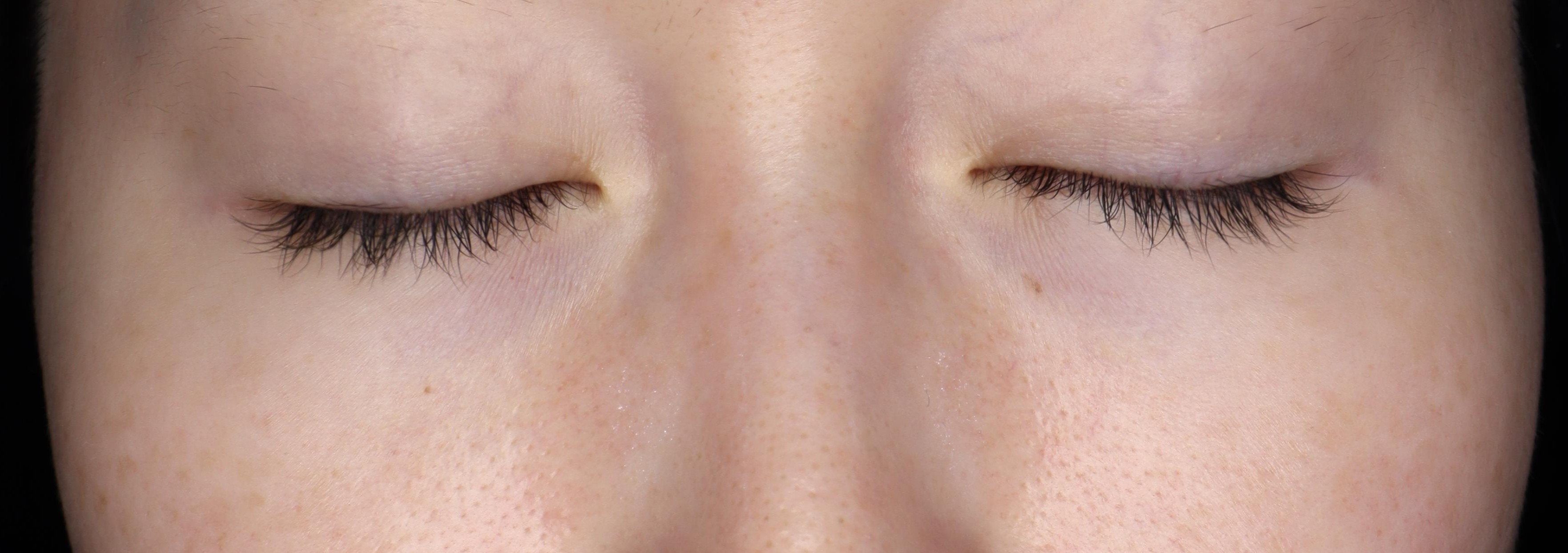 Before（ビフォー）