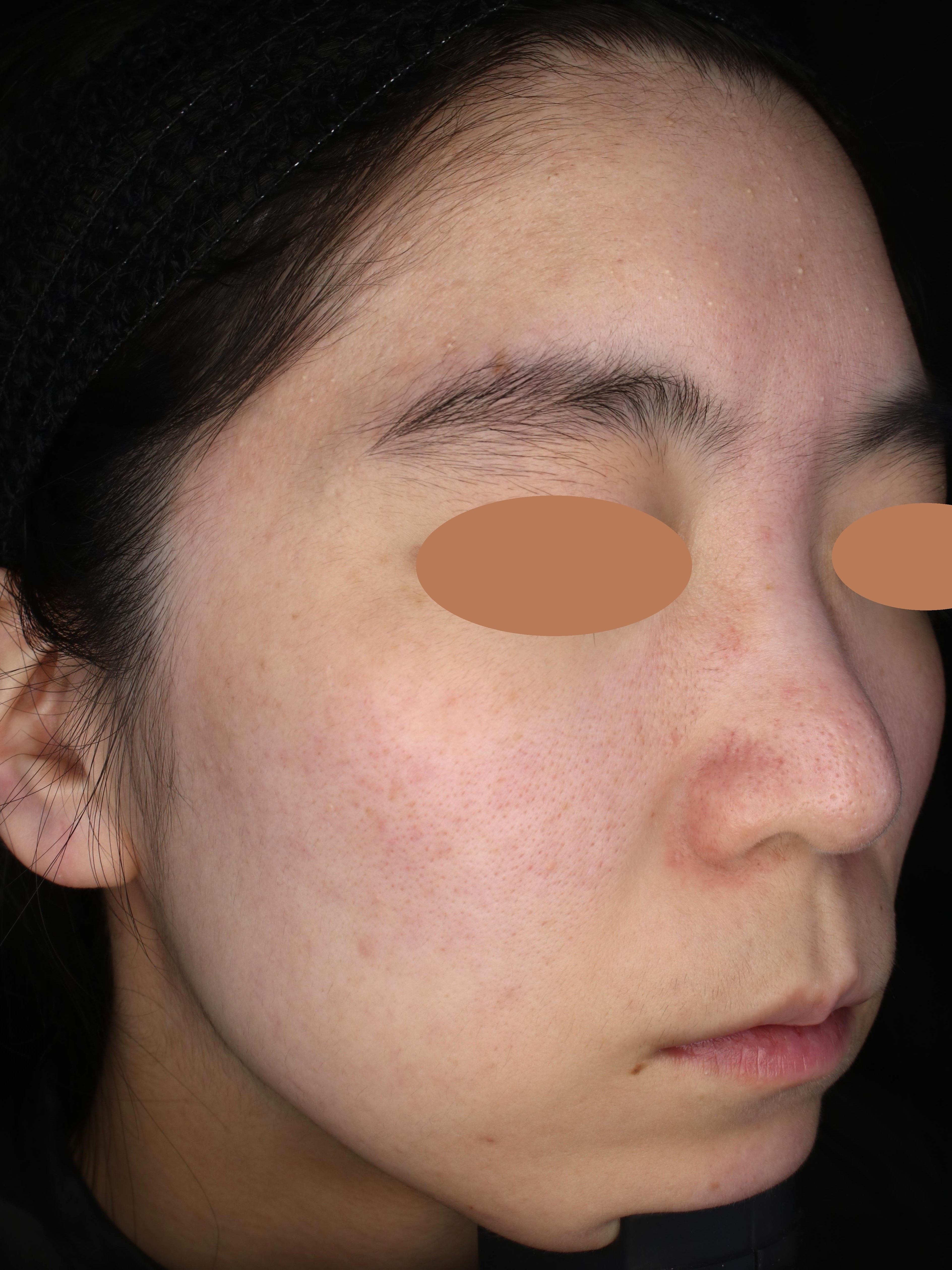 Before（ビフォー）