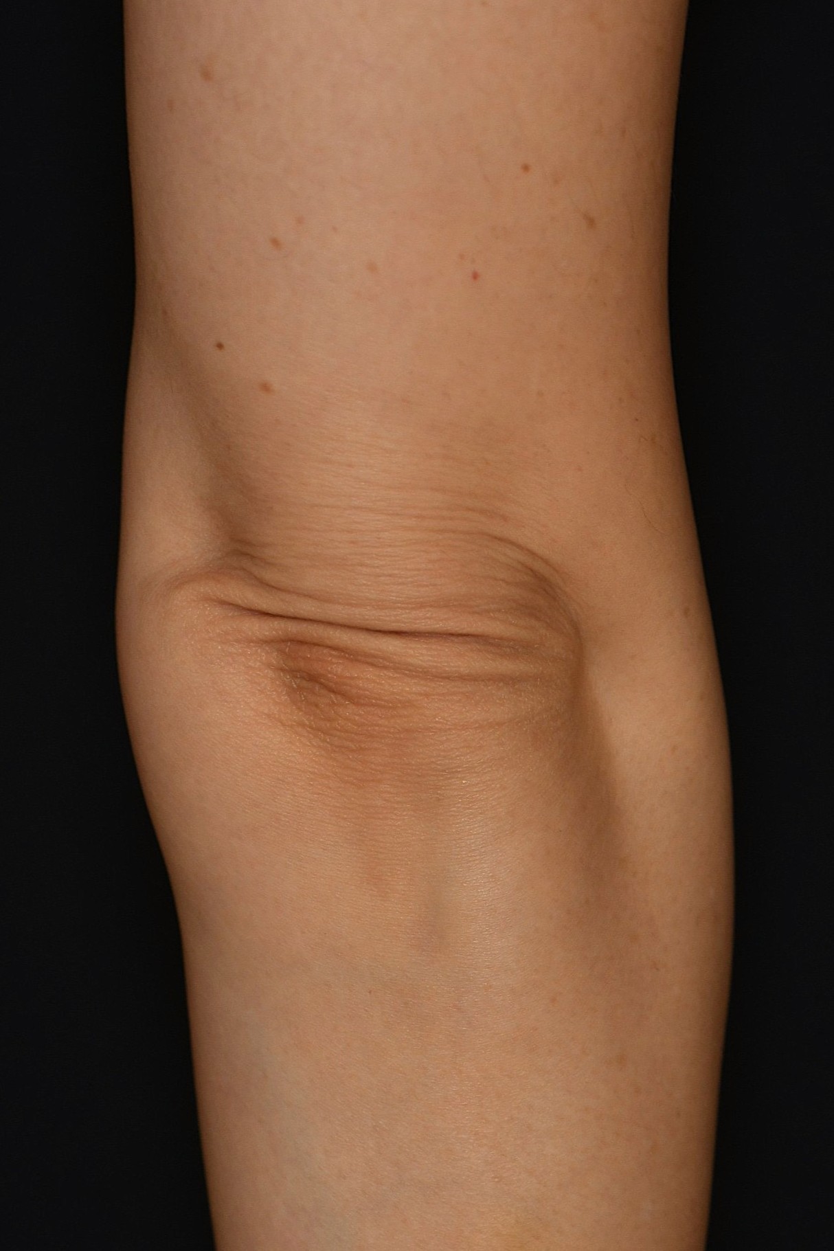 After（アフター）