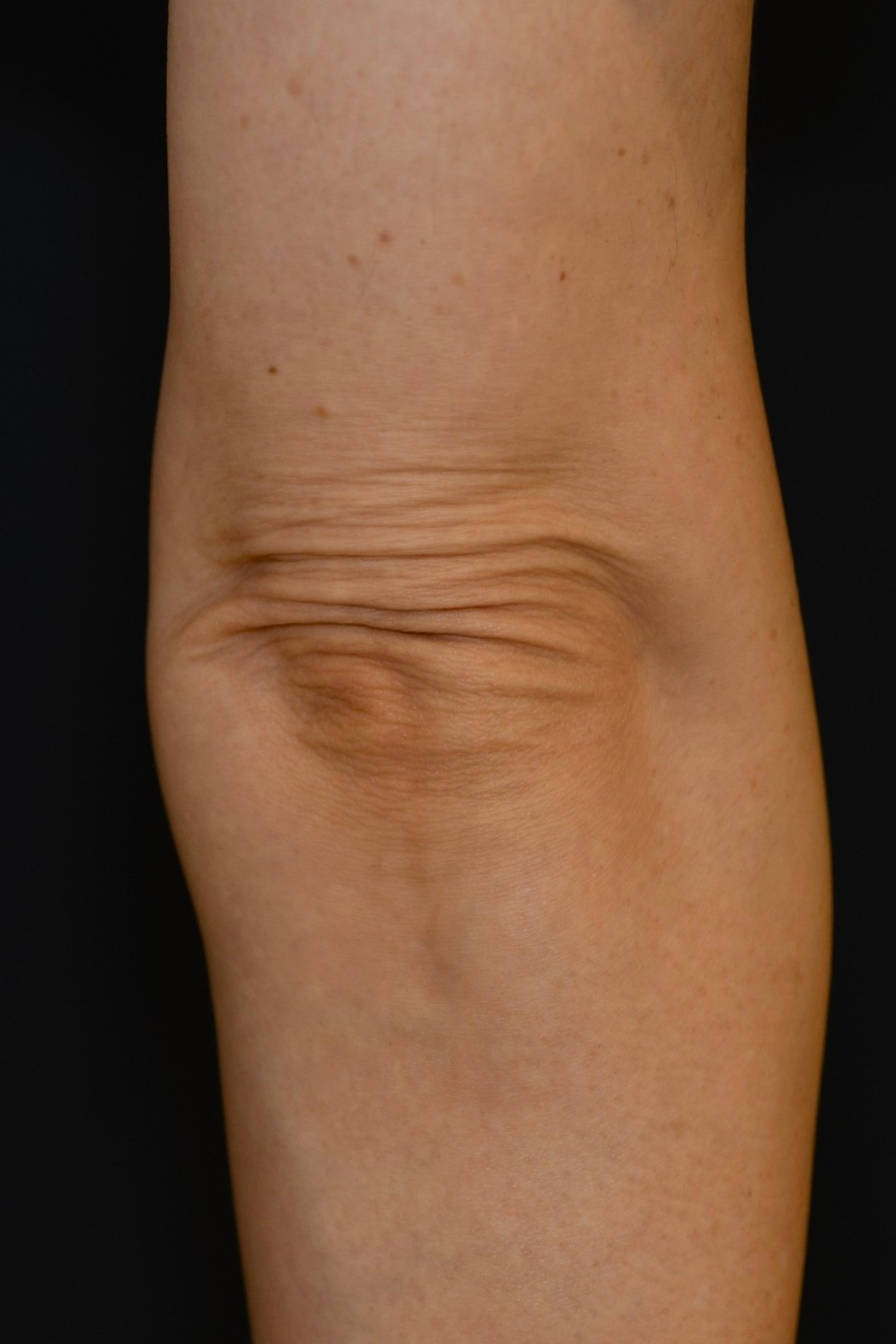 Before（ビフォー）