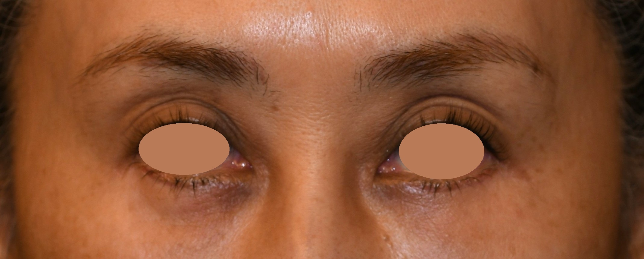 After（アフター）