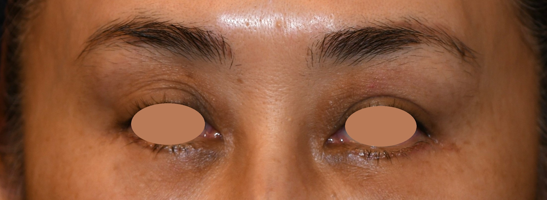 Before（ビフォー）