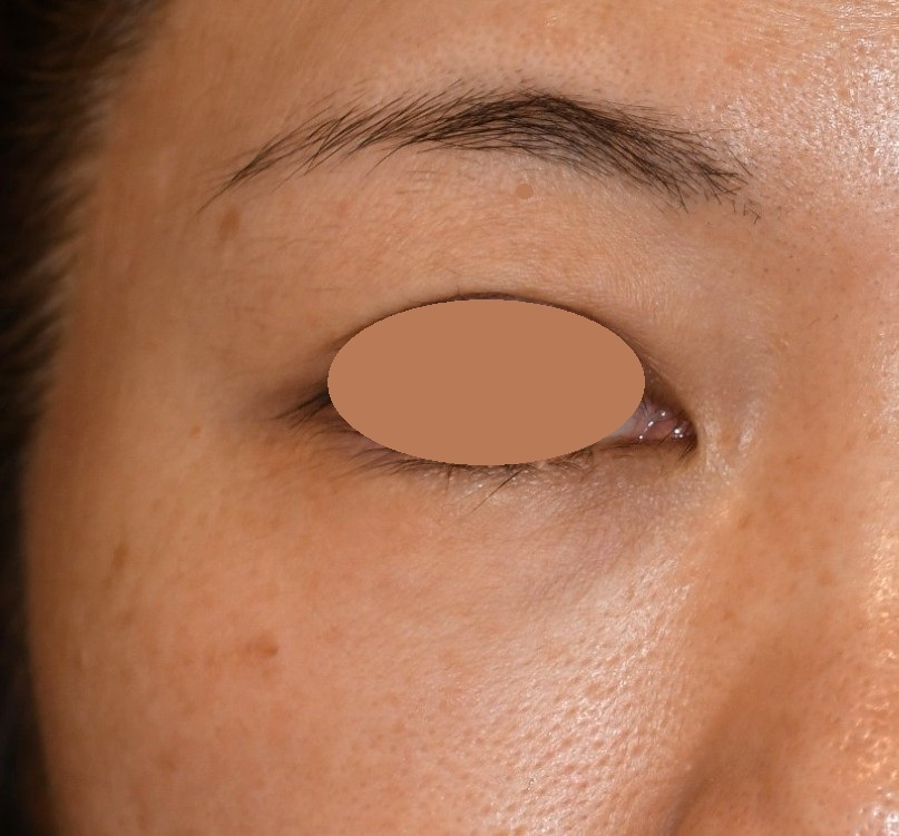 After（アフター）