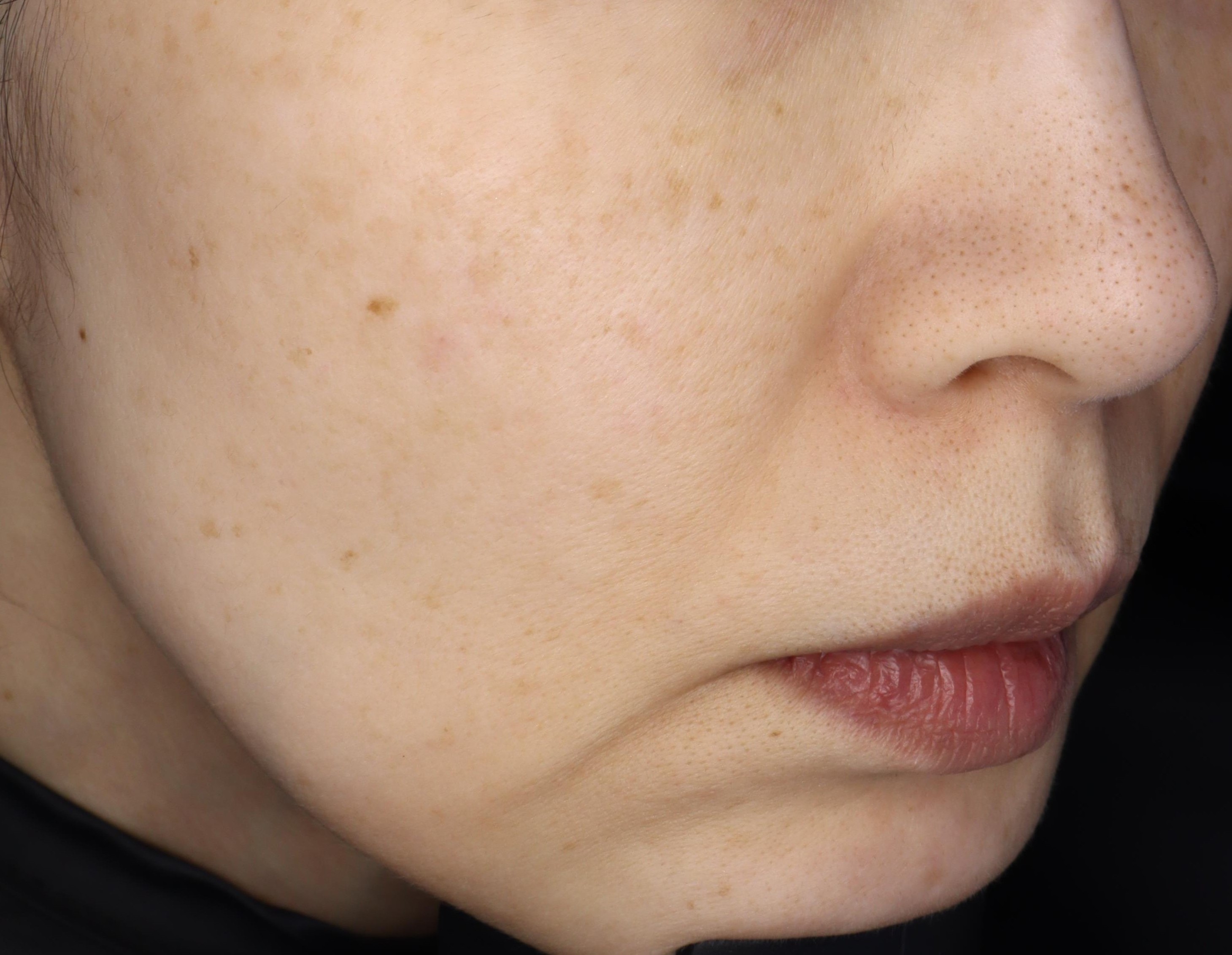 After（アフター）