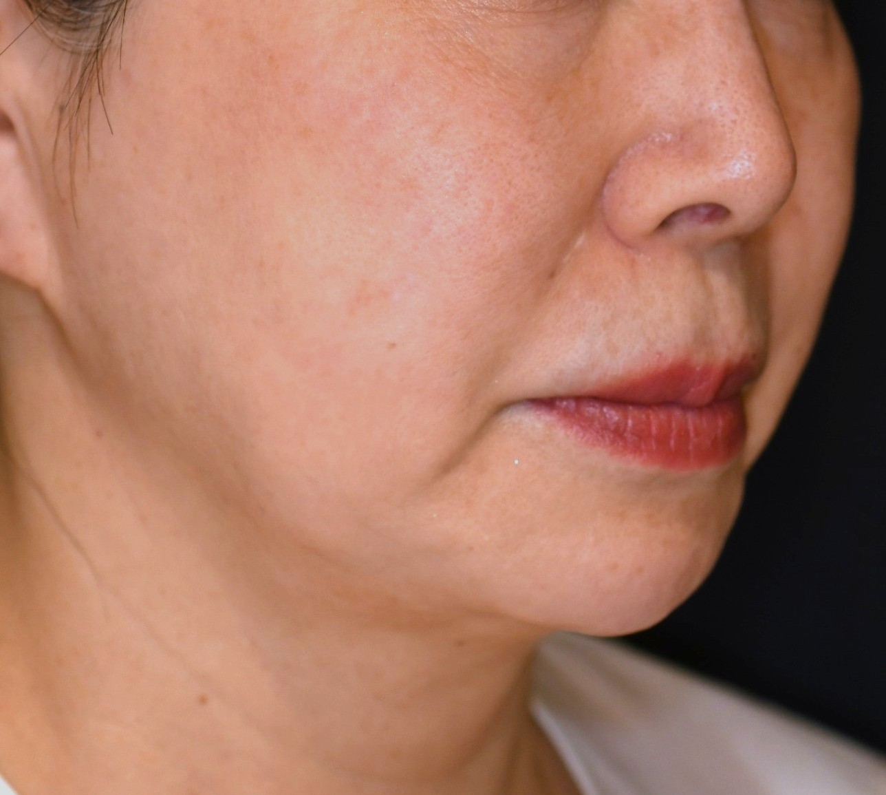 After（アフター）