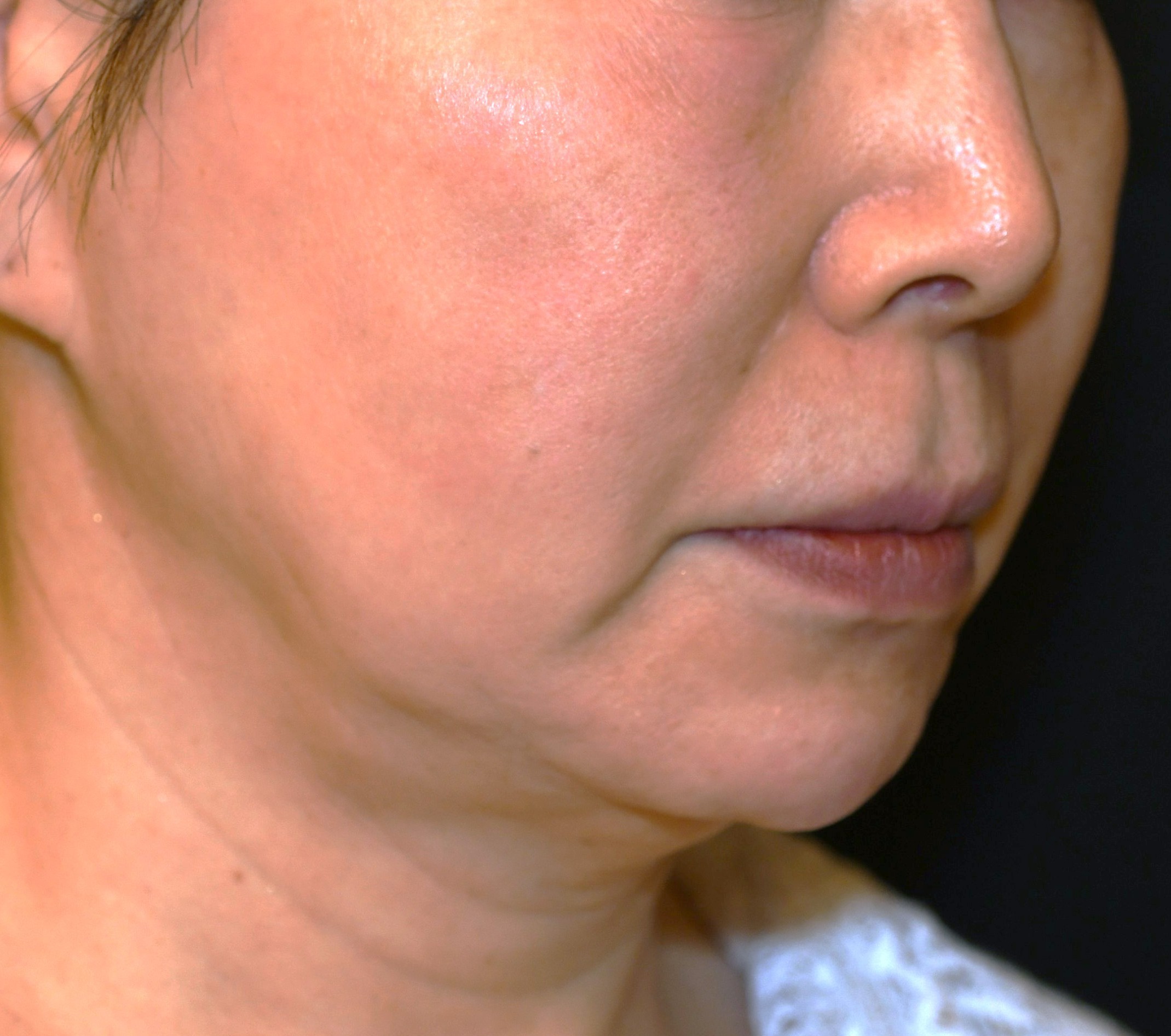 Before（ビフォー）