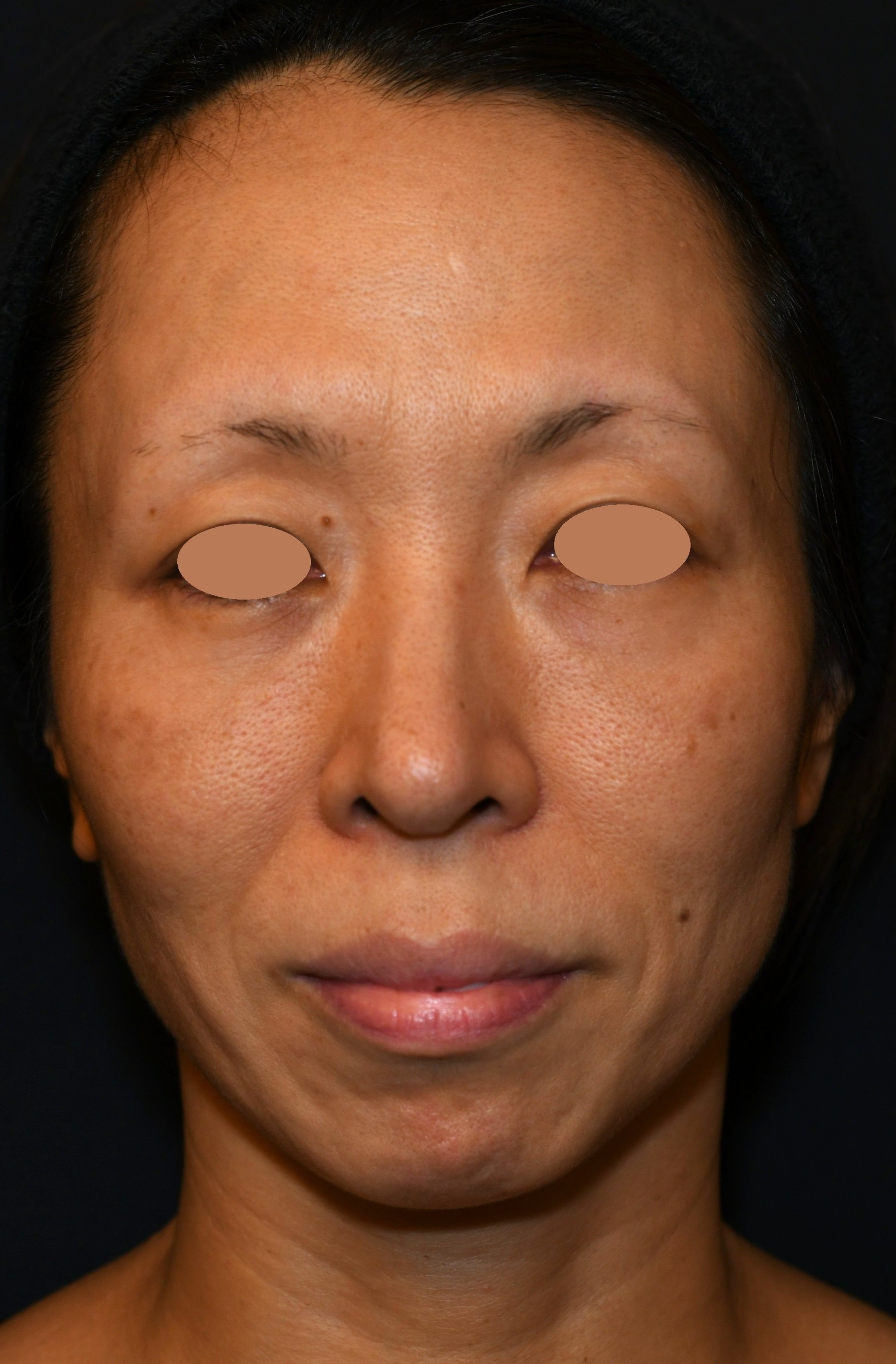 Before（ビフォー）