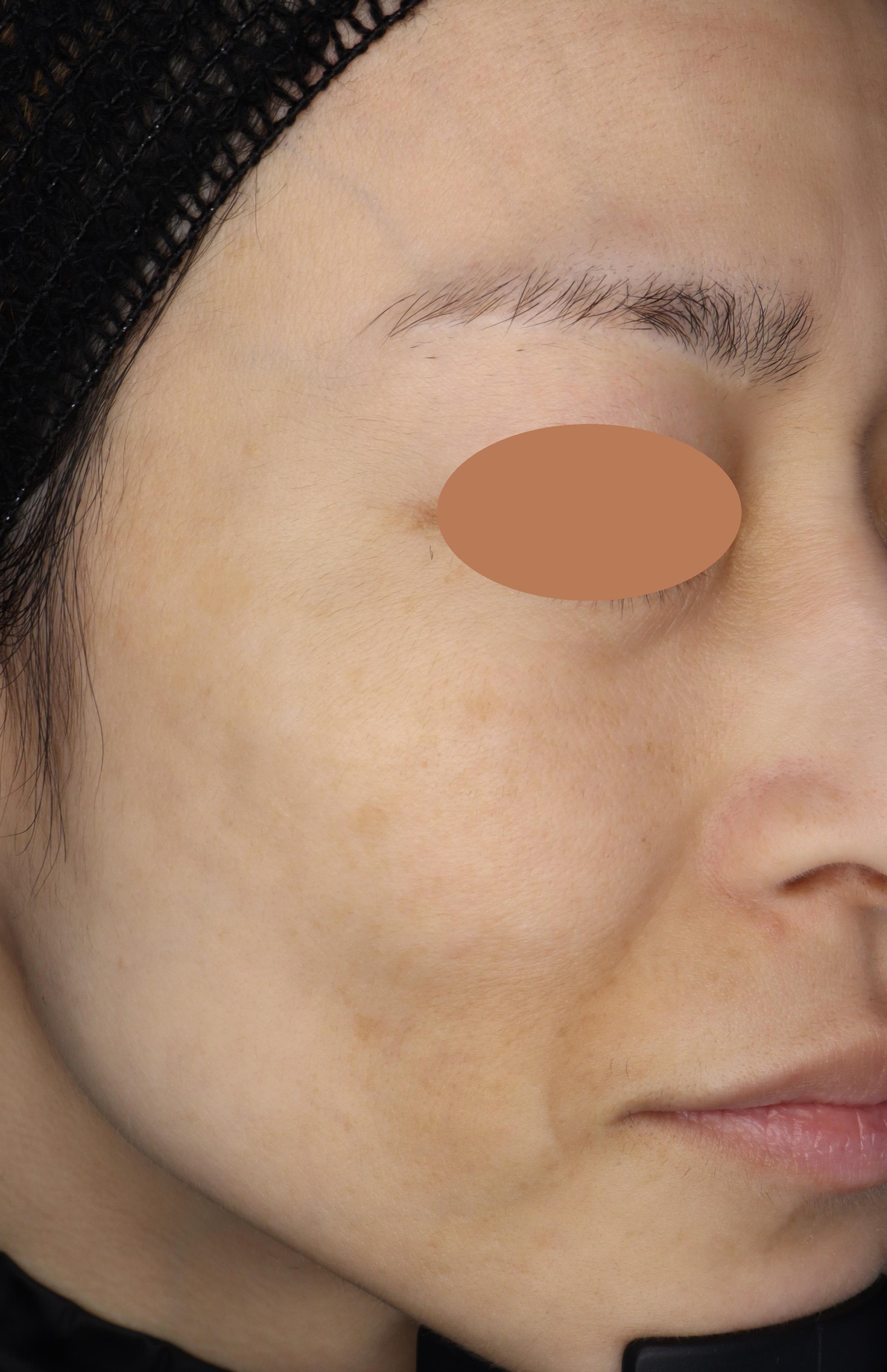 After（アフター）