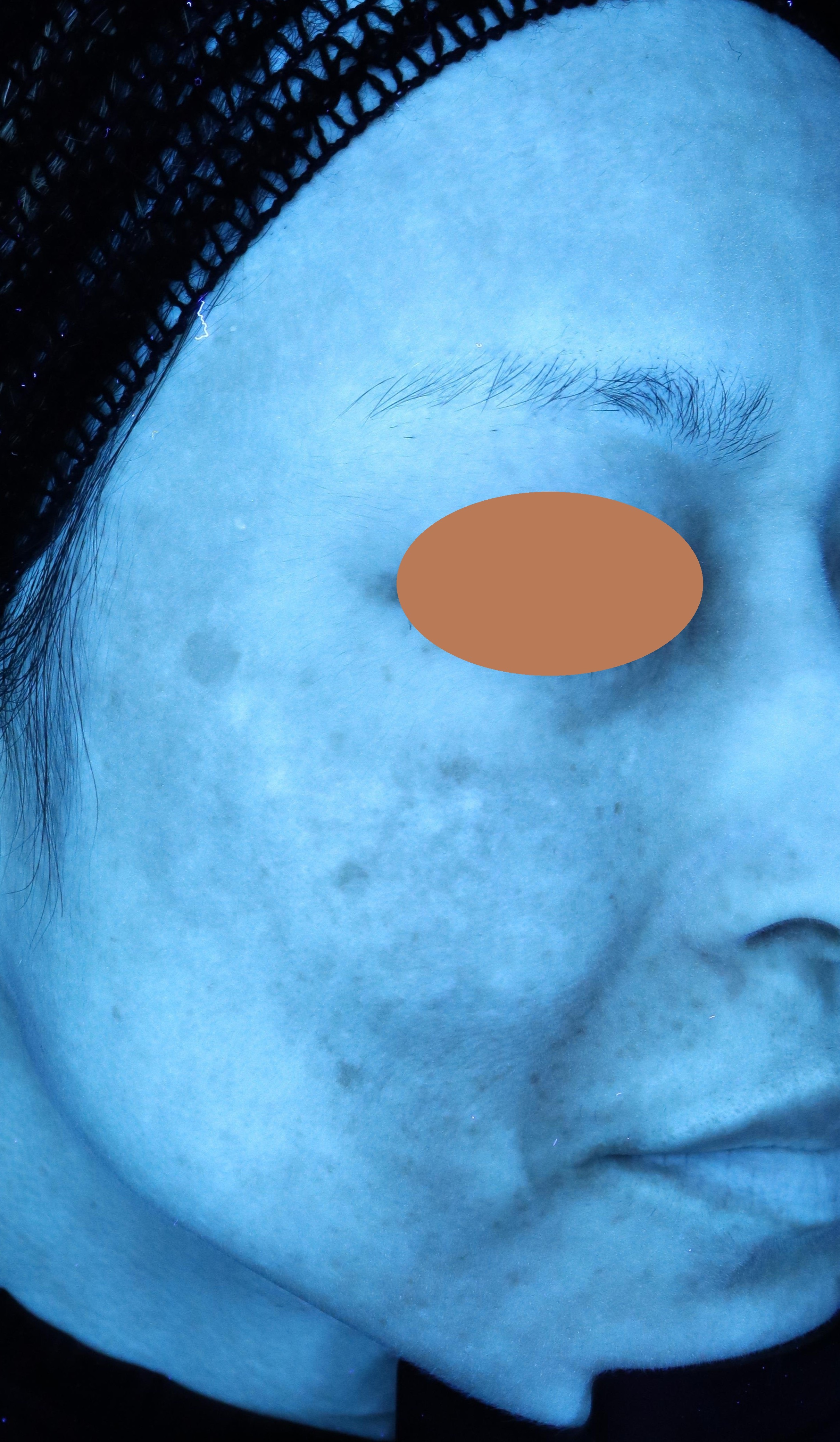 After（アフター）