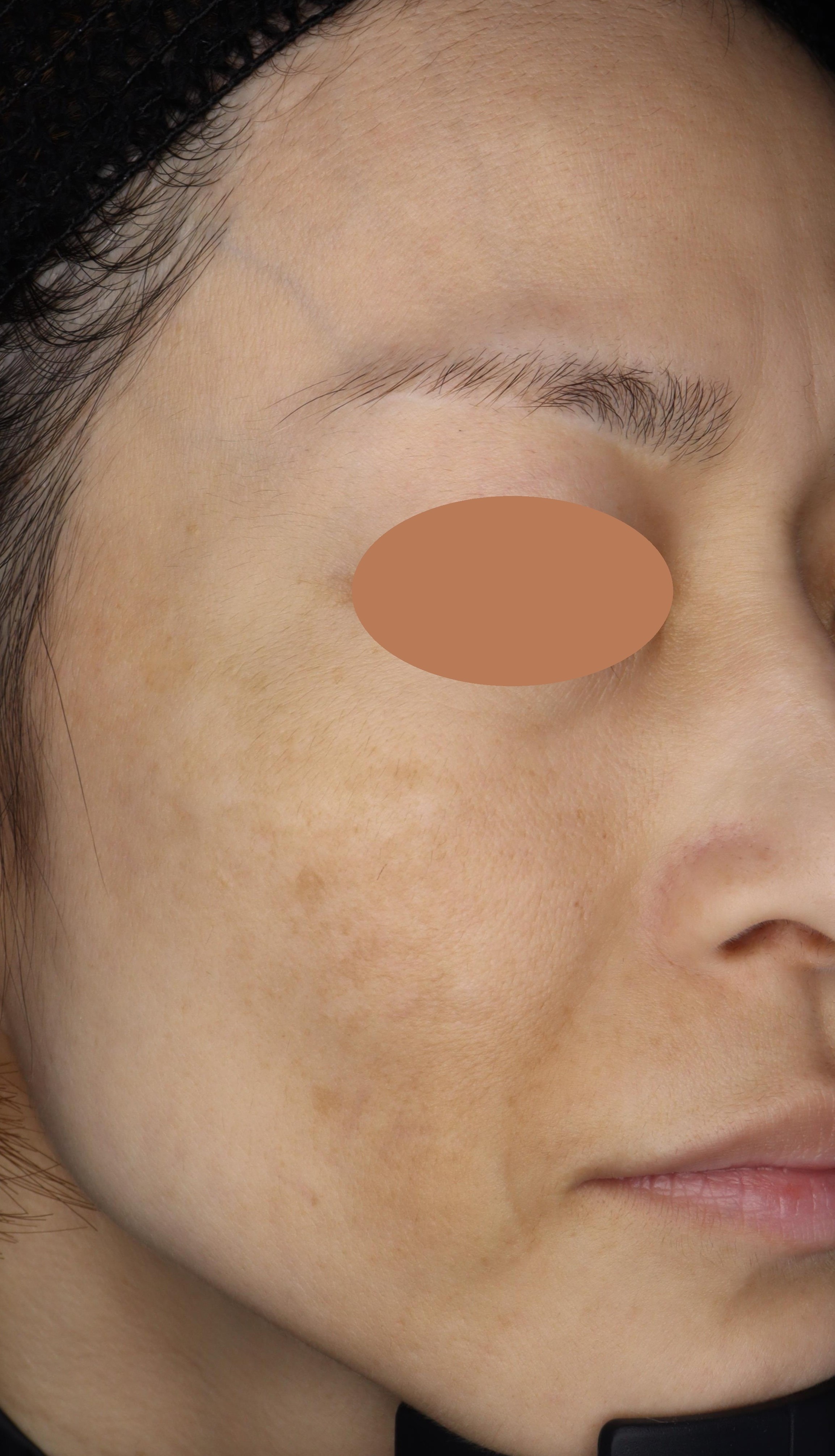 Before（ビフォー）