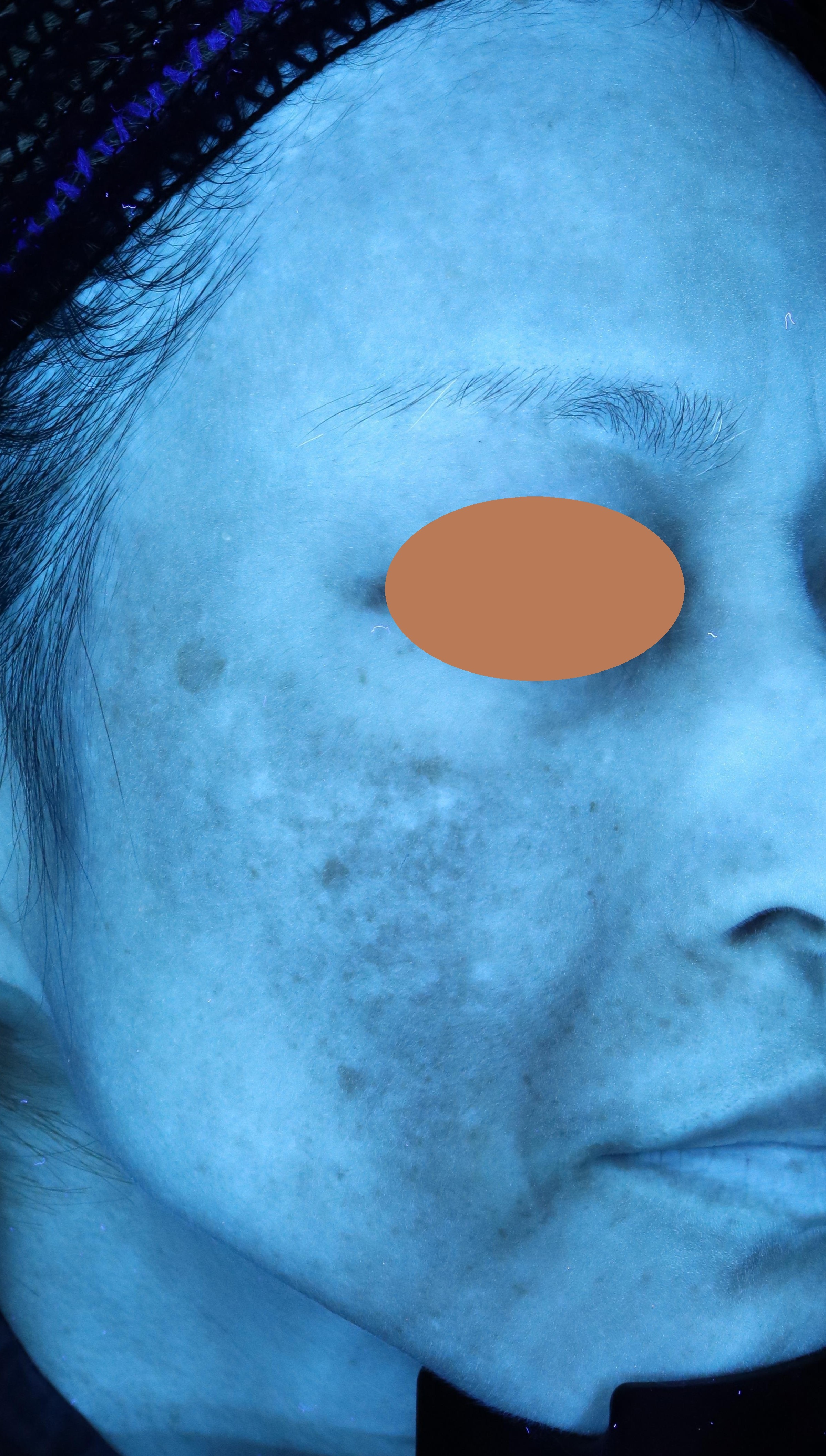 Before（ビフォー）