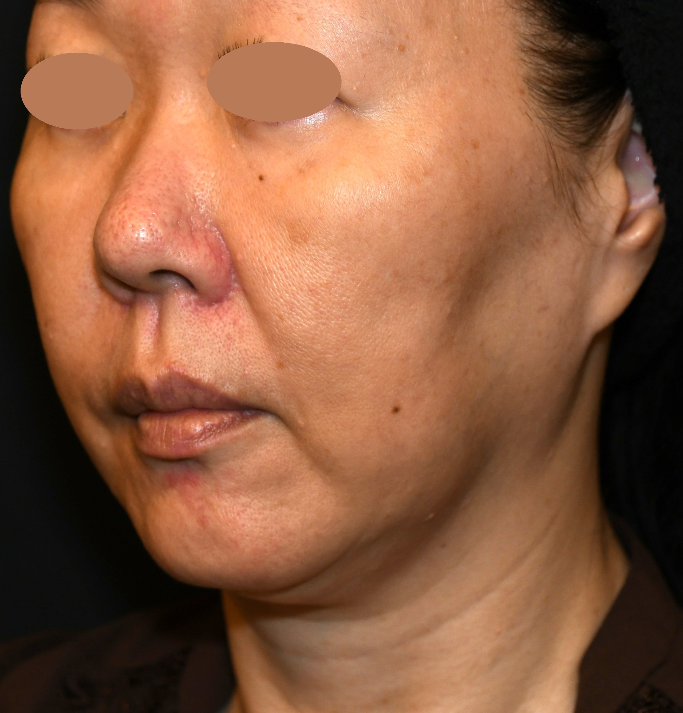 After（アフター）