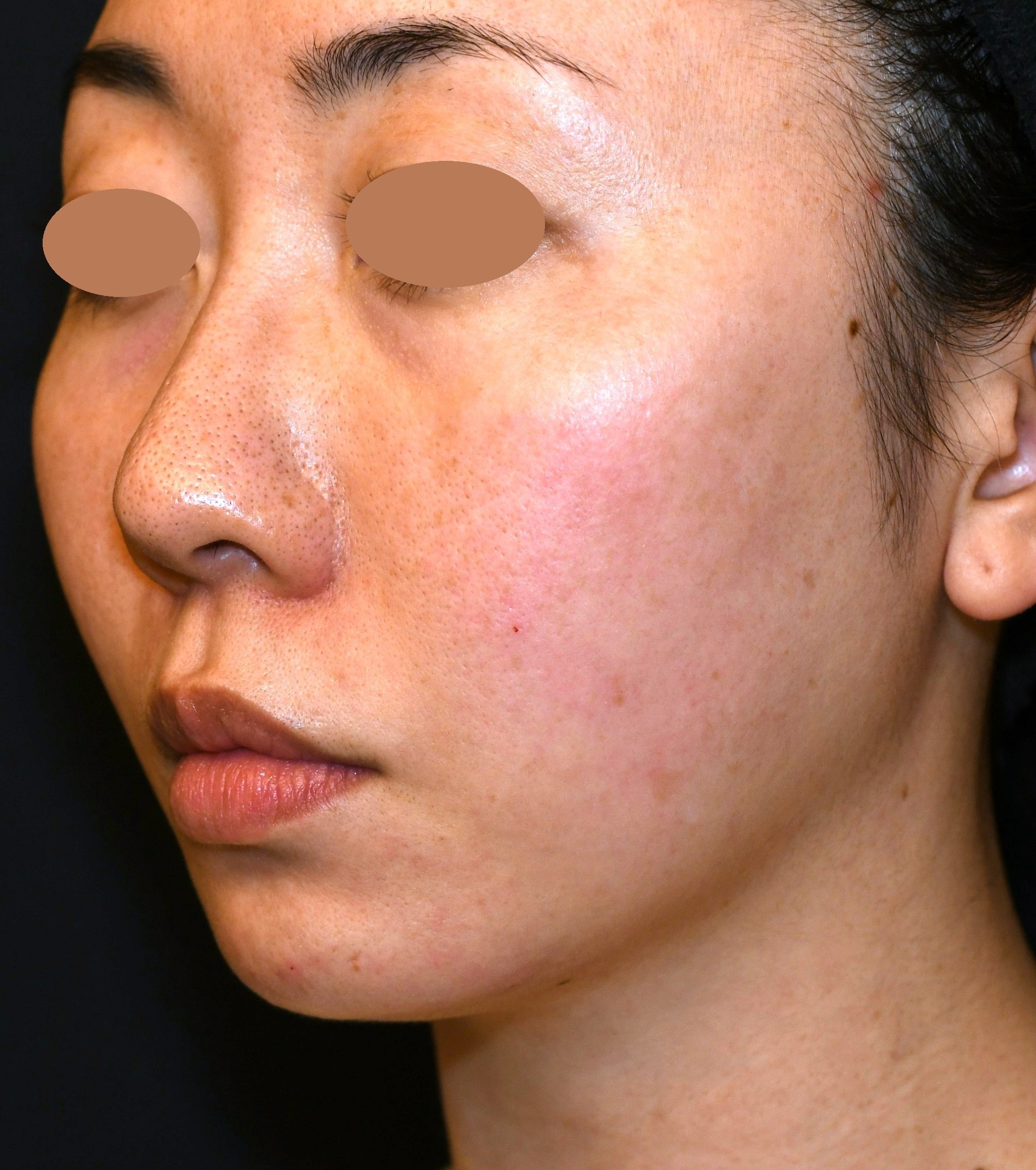 After（アフター）