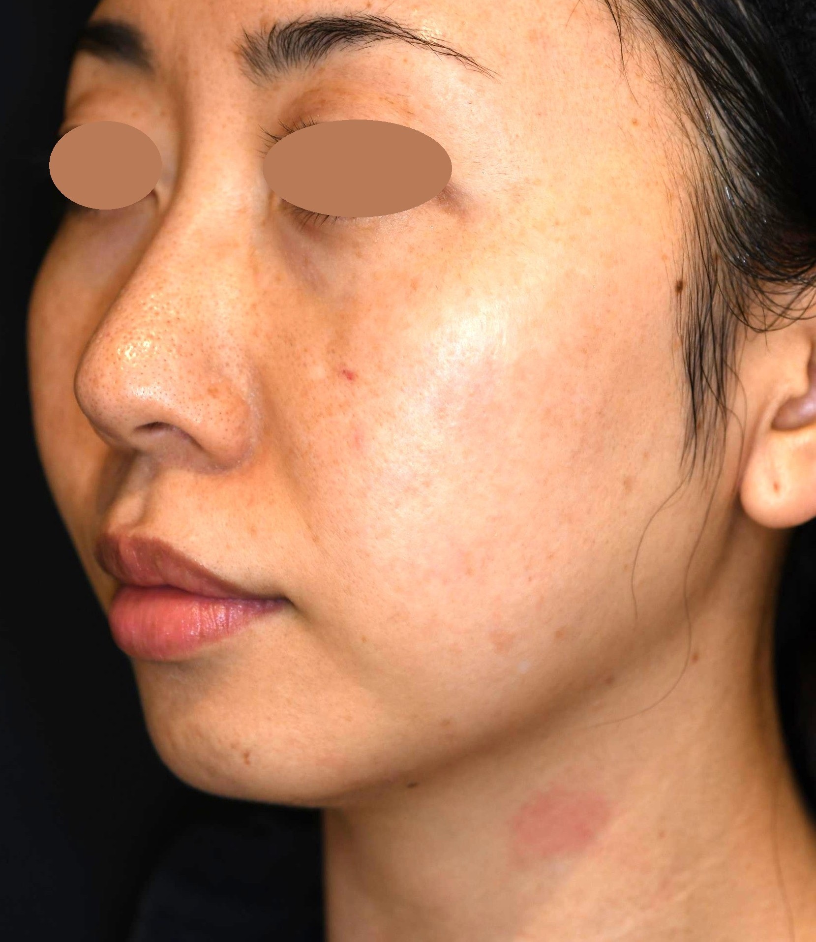 Before（ビフォー）