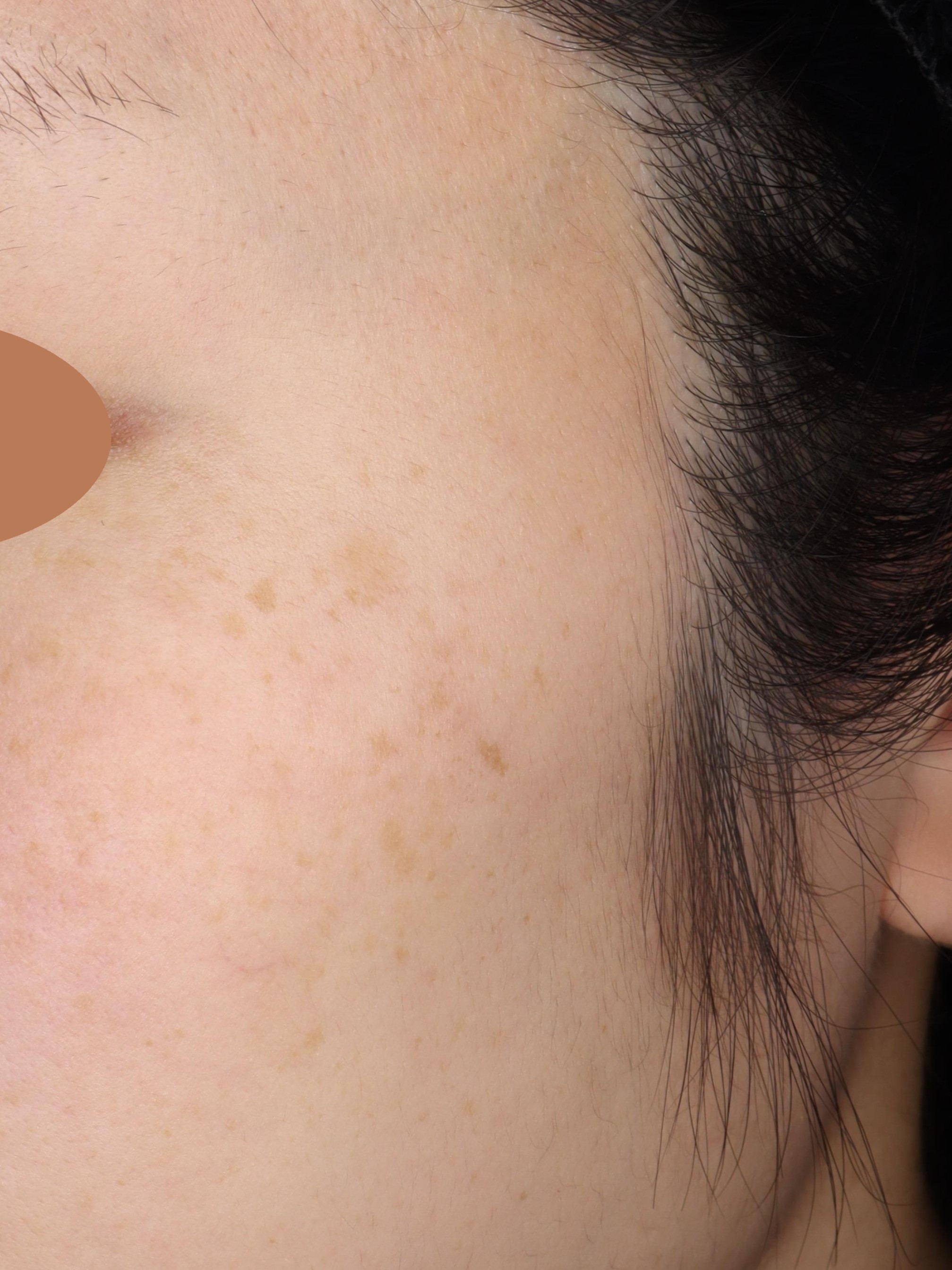 After（アフター）