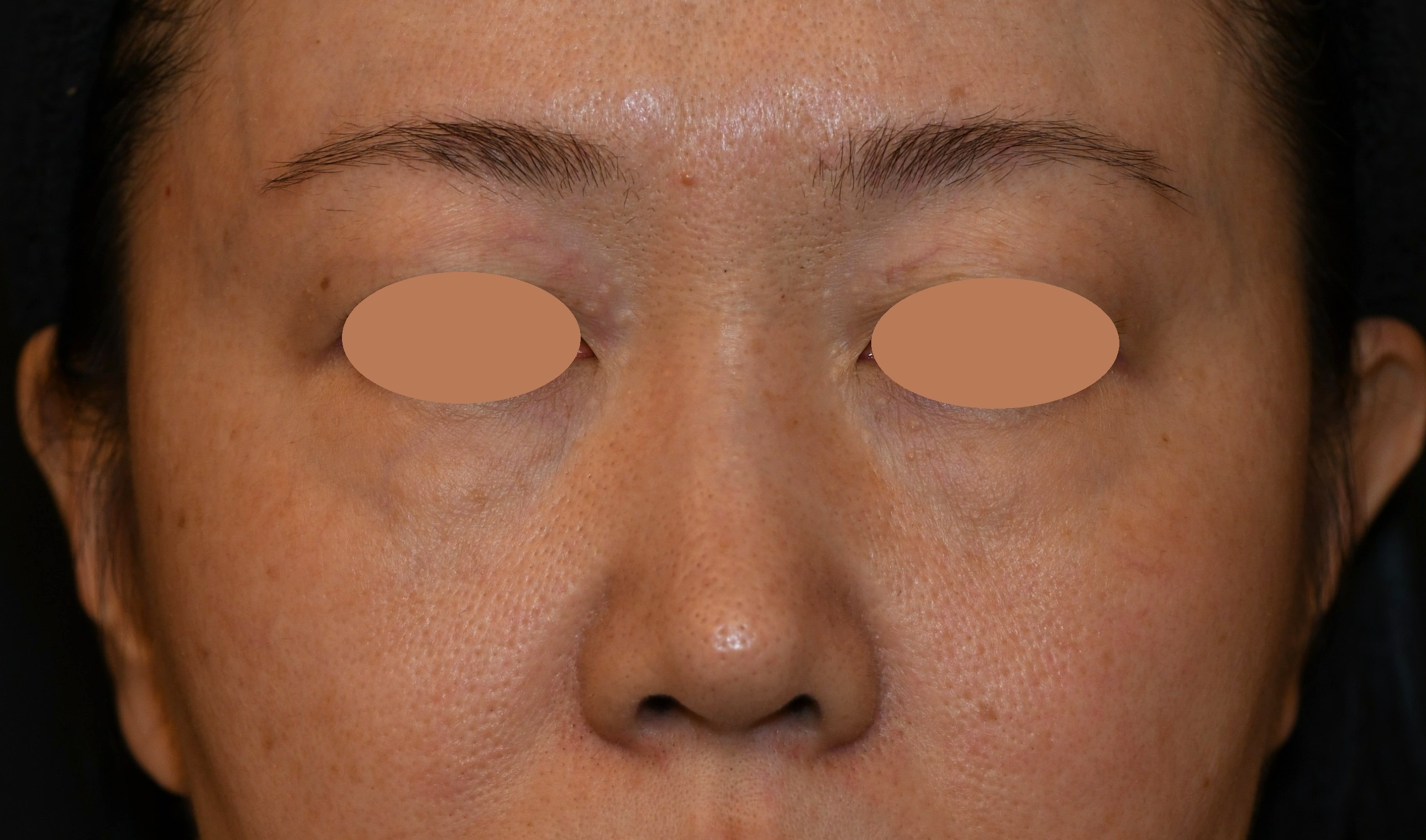 After（アフター）