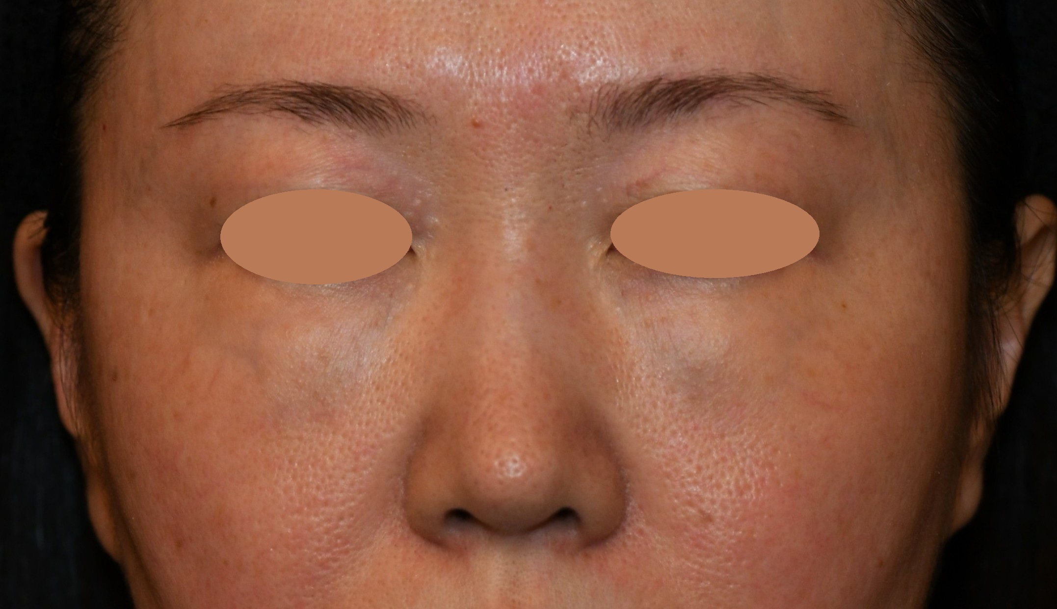 Before（ビフォー）