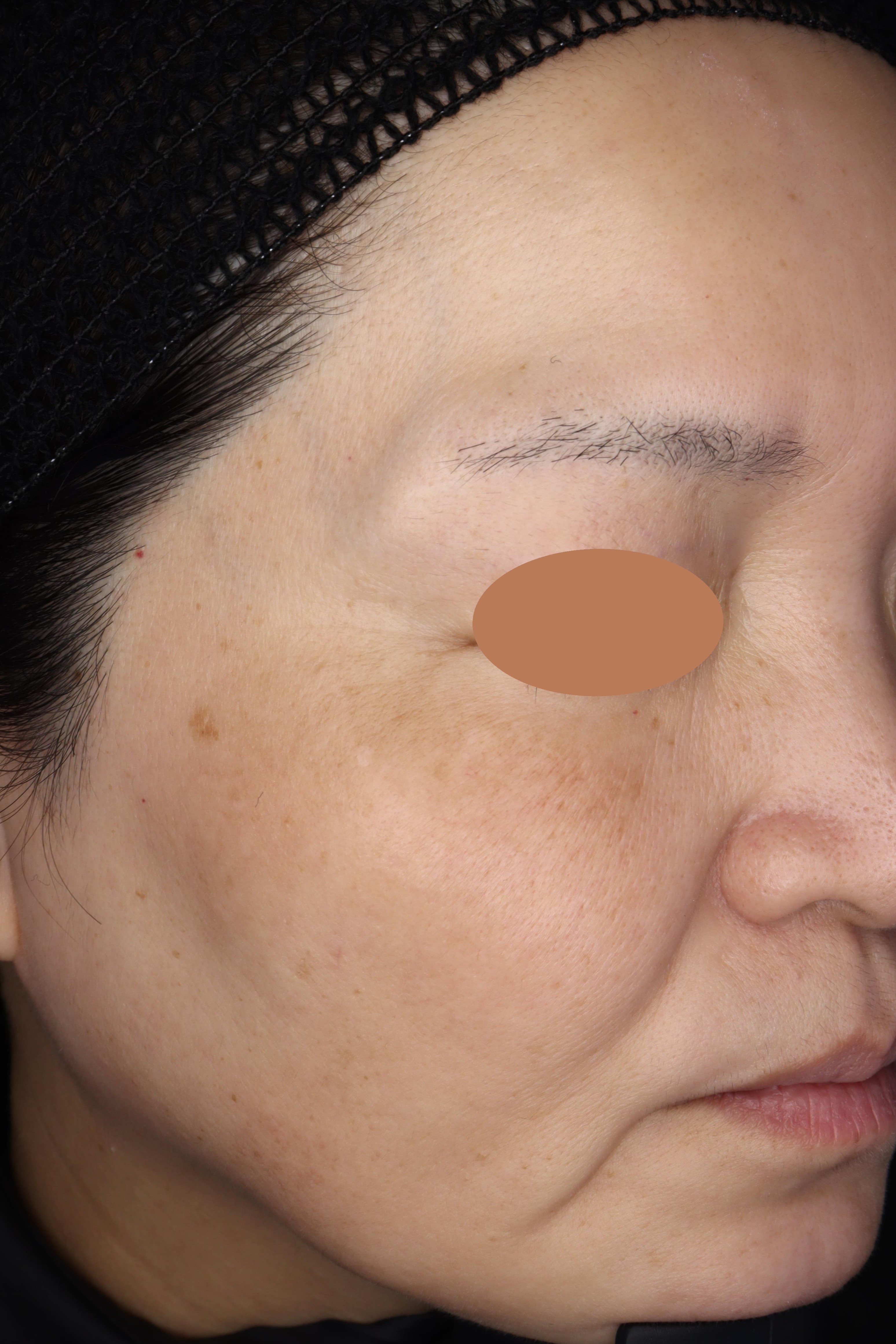 Before（ビフォー）