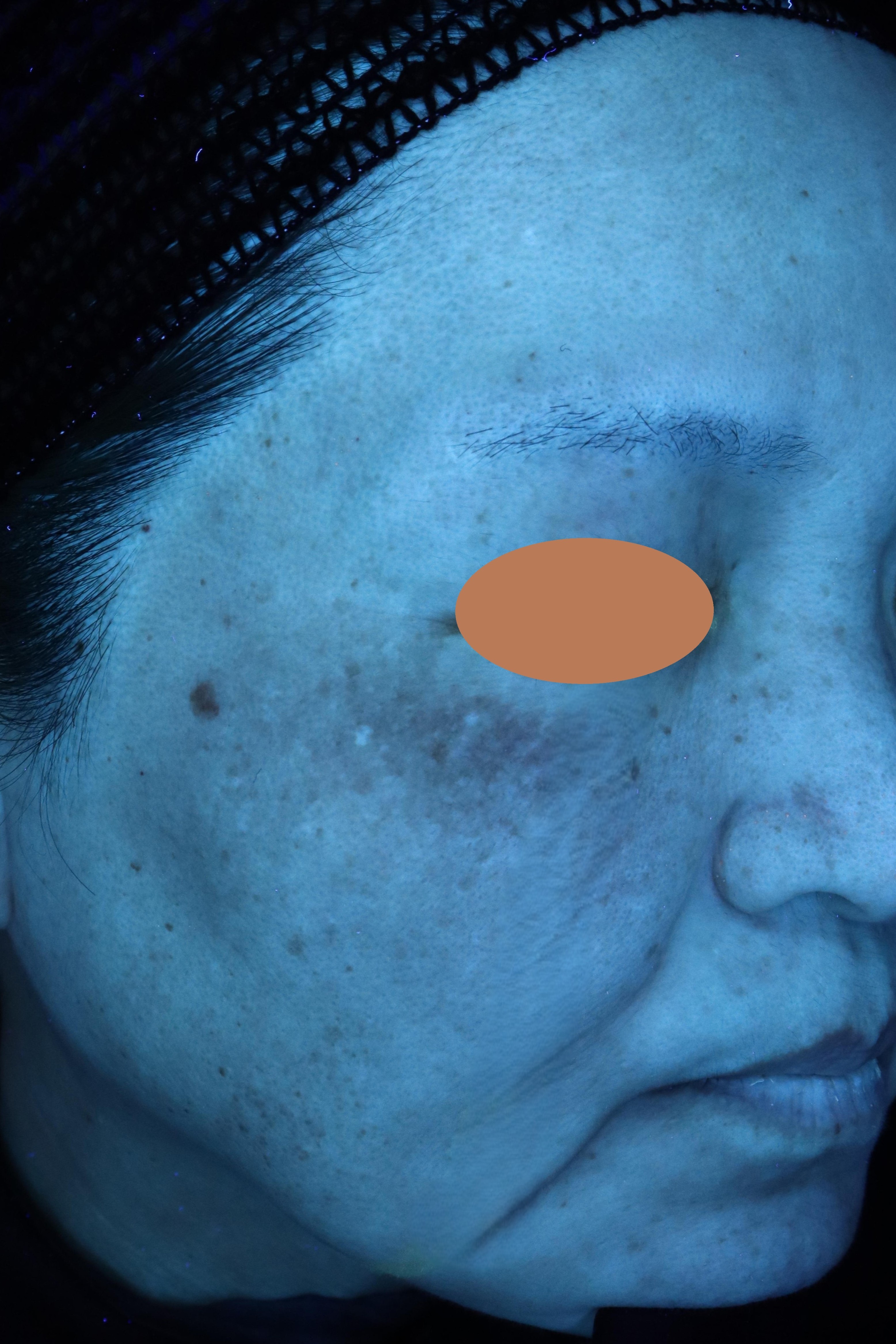 Before(ビフォー)